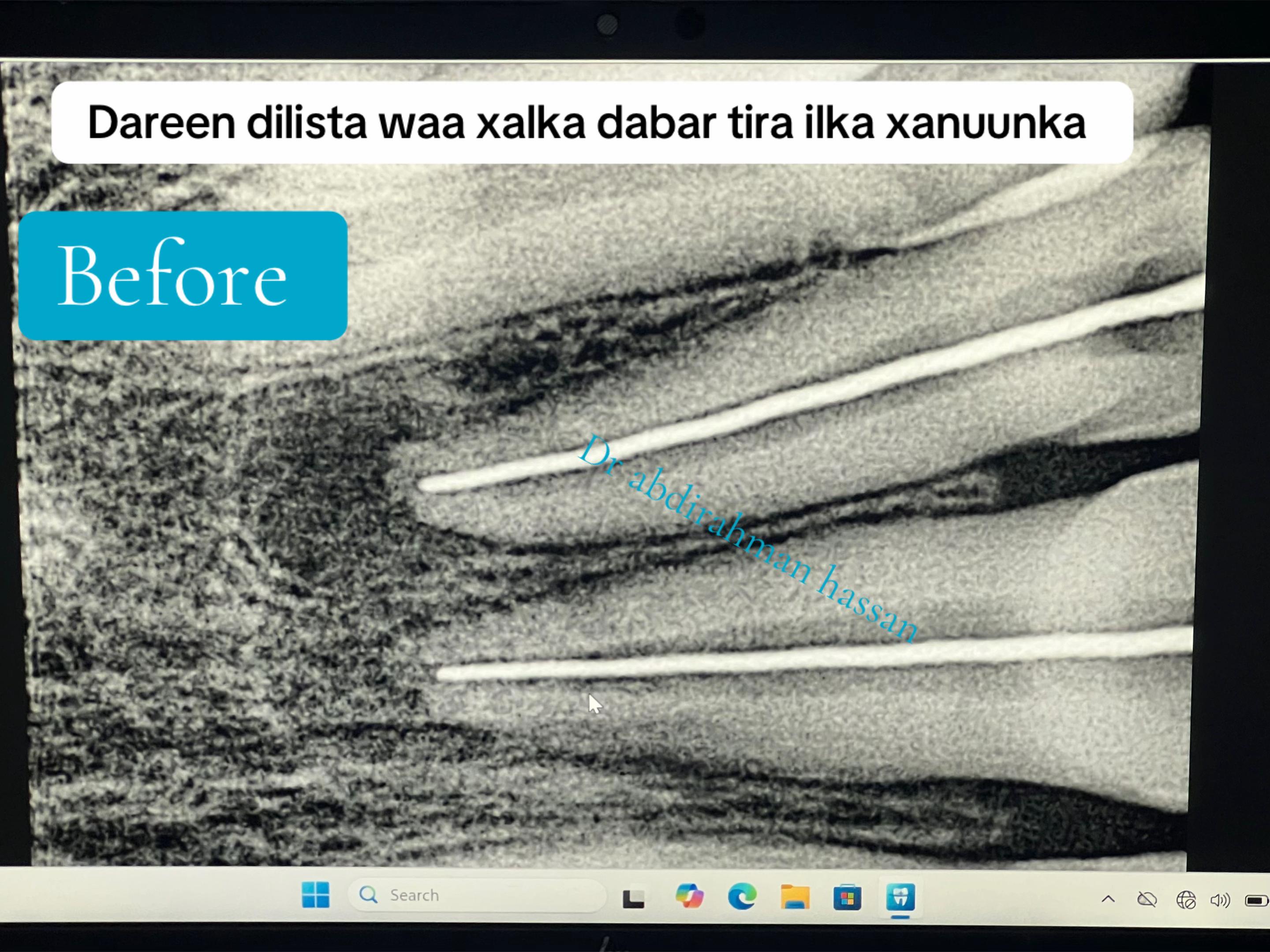 @Dr Abdirahman hassan laari