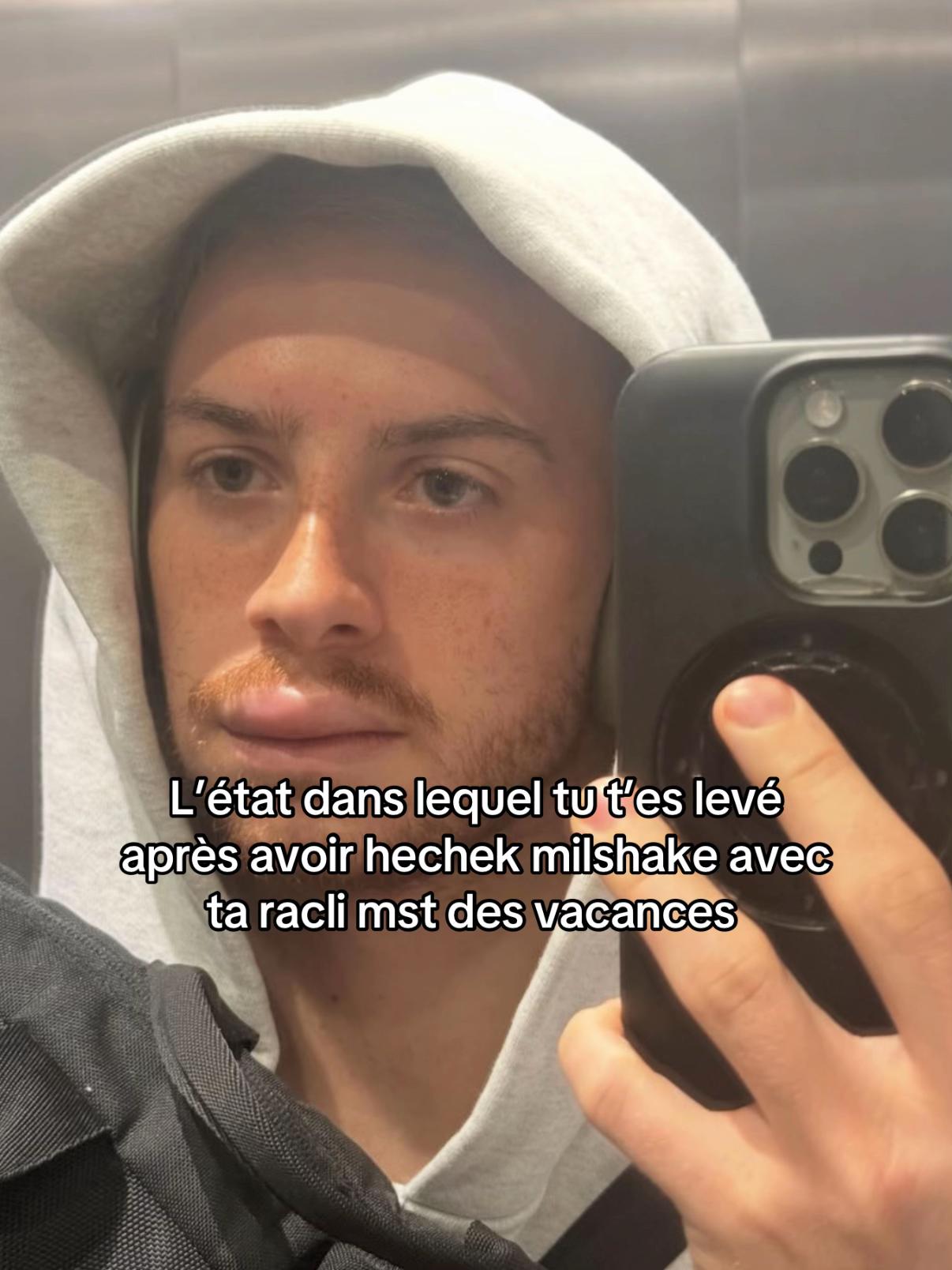 @Lakr&atilde;ps