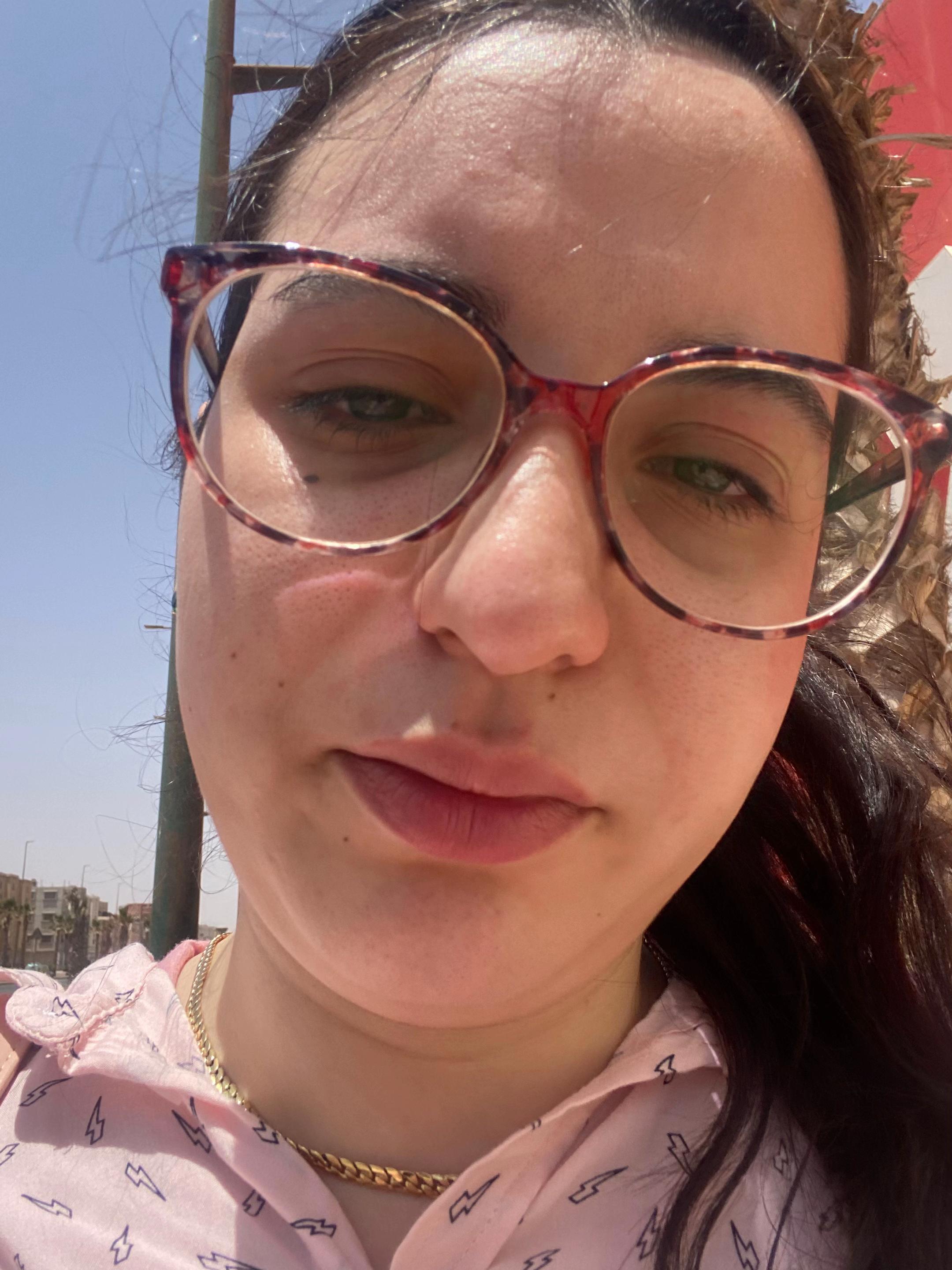@Essatz