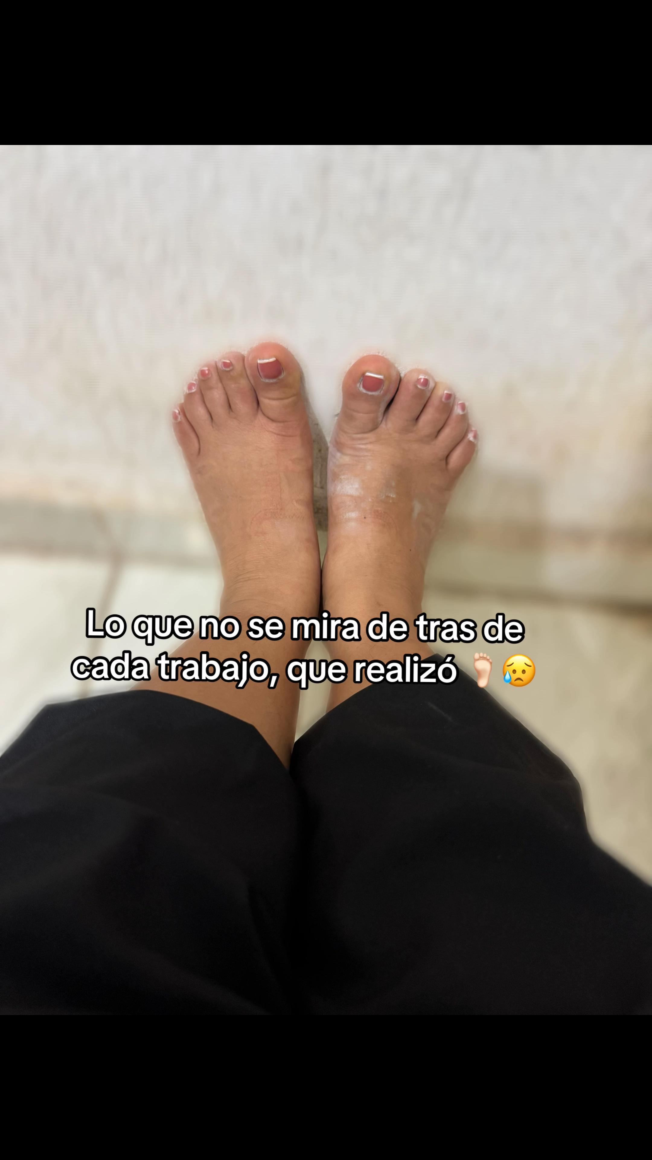@Ady Gallardo