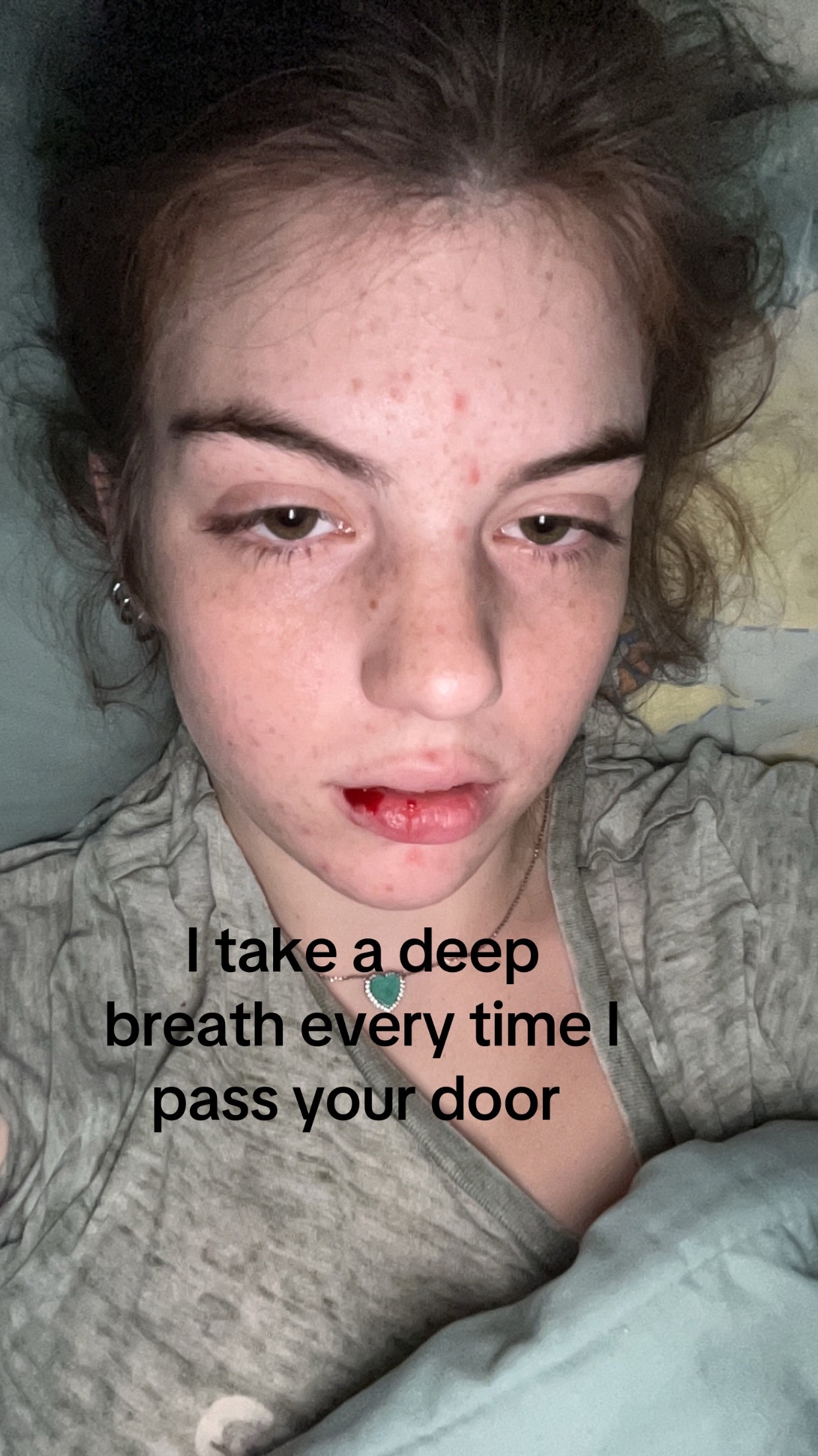@Emma