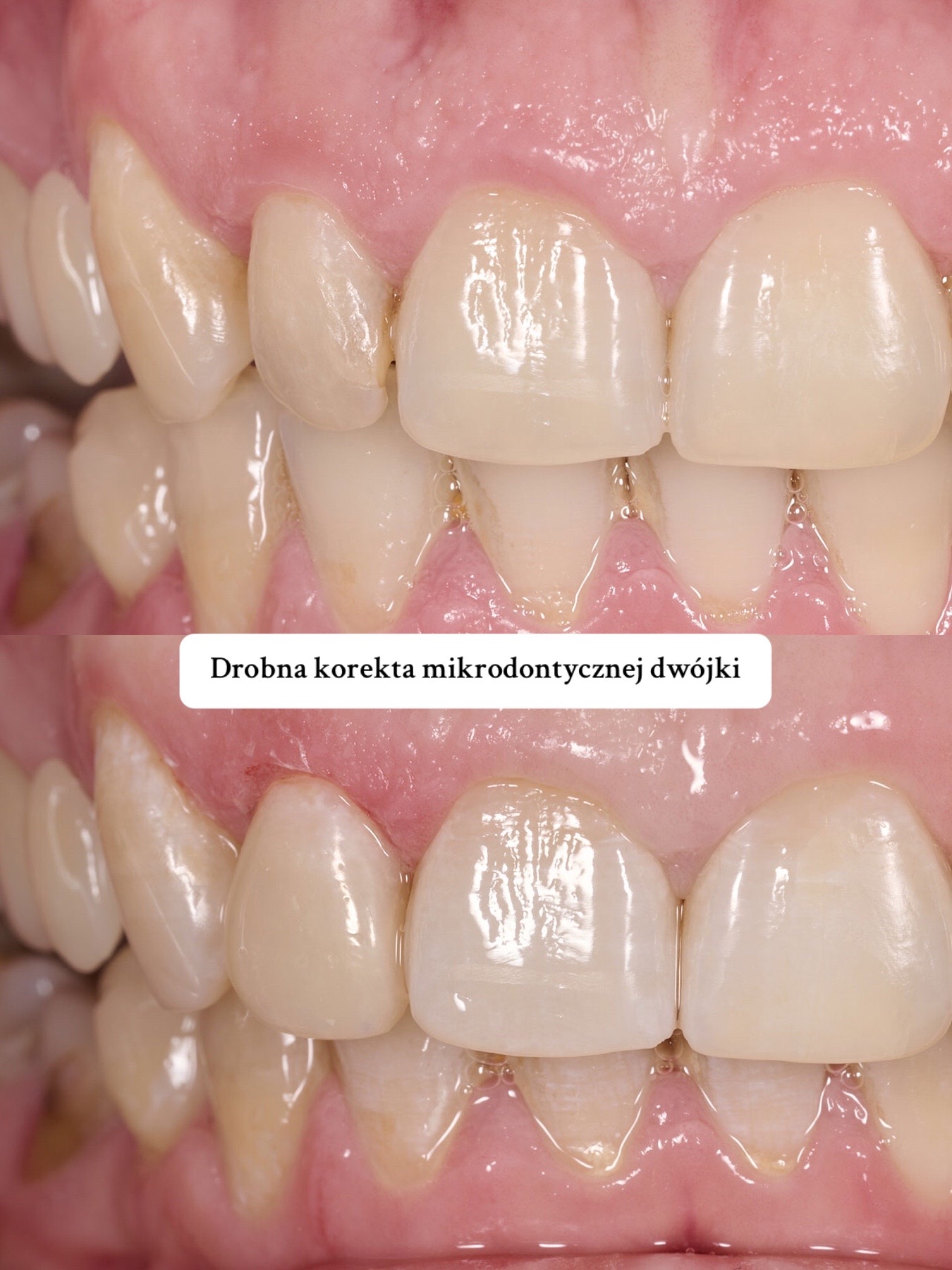 @Anna 🦷 dentystka