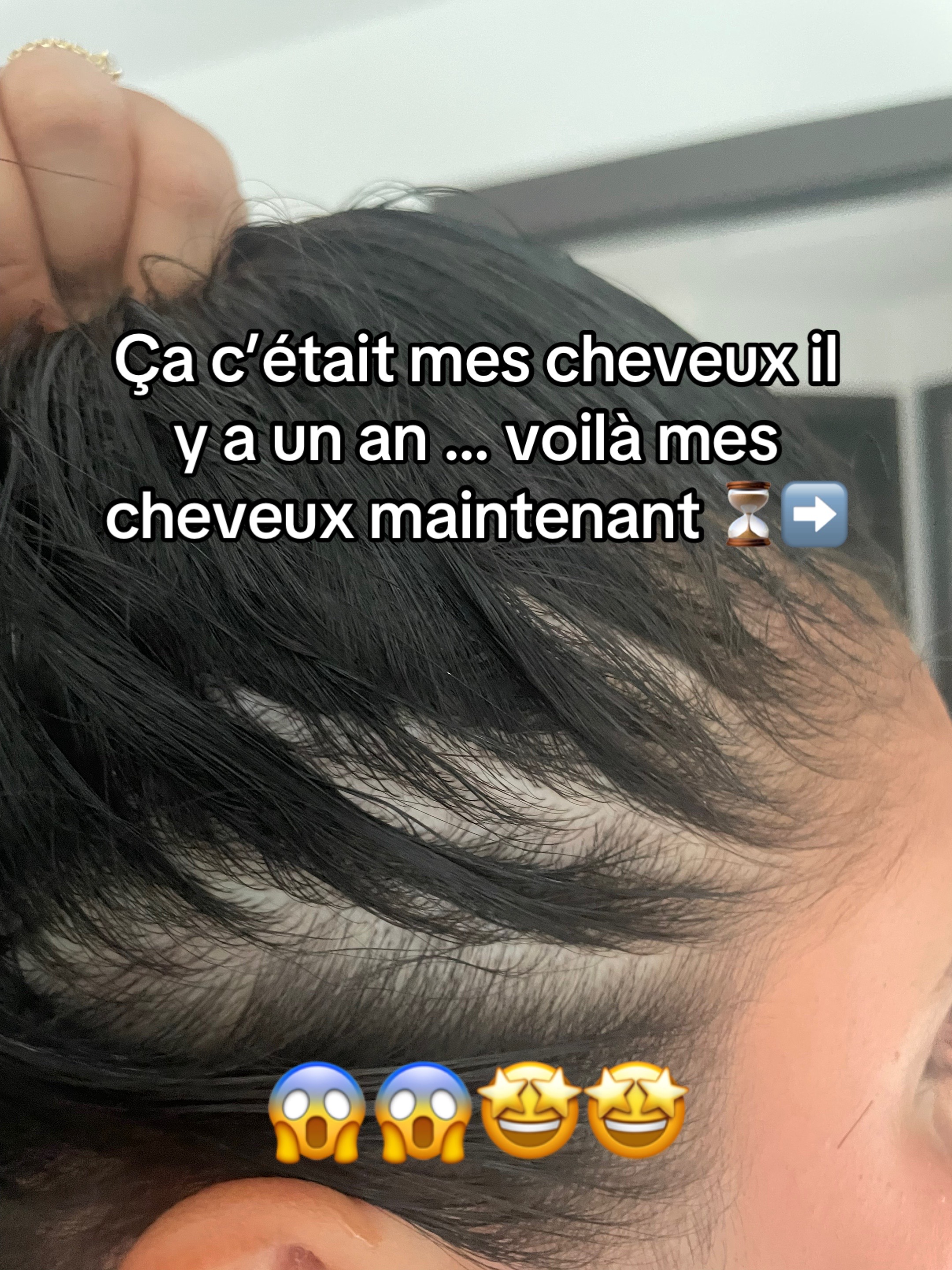 @Lux’Hair Growth FR