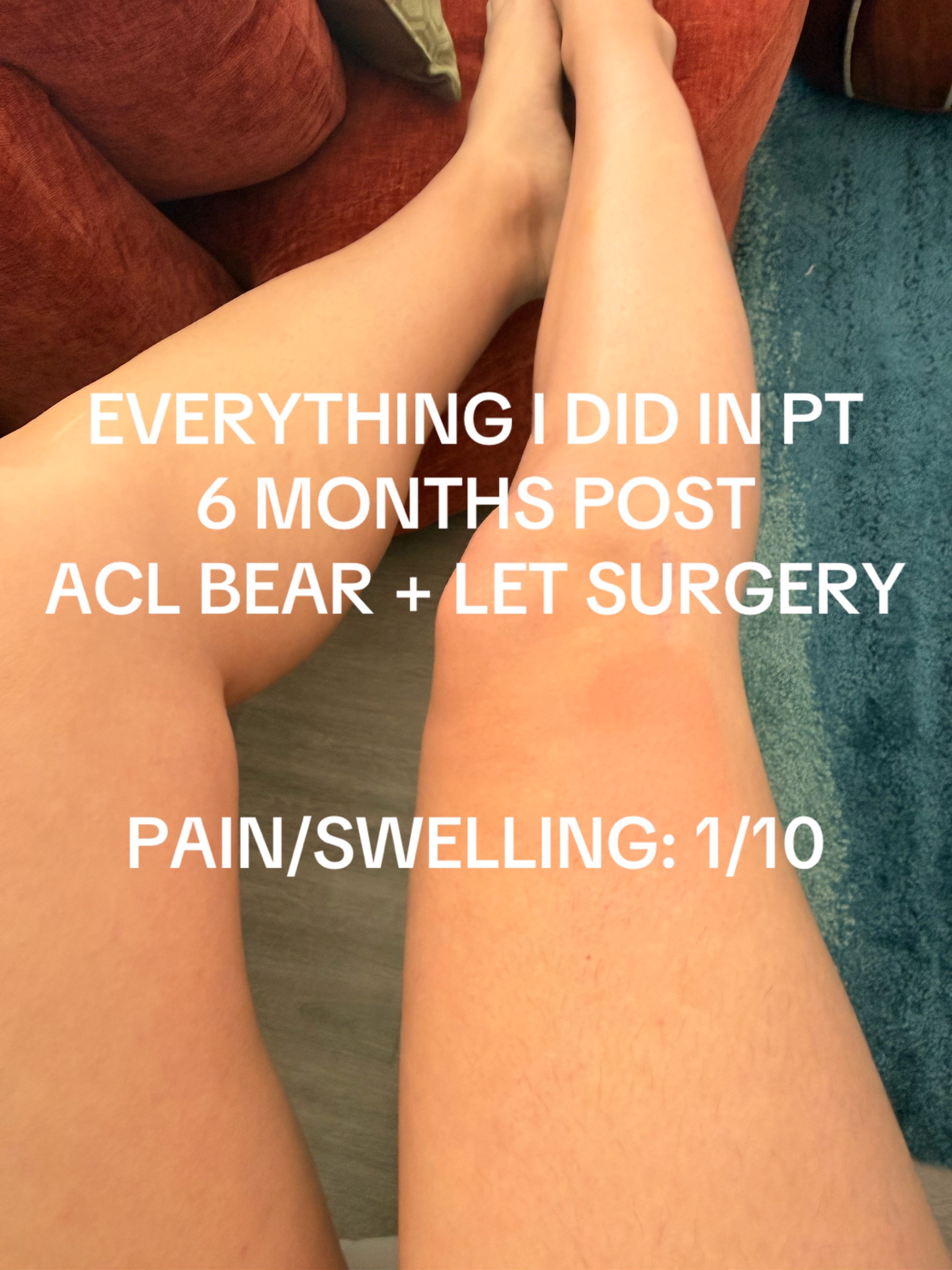 @Shelbs // ACL Recovery ❤️&zwj;🩹