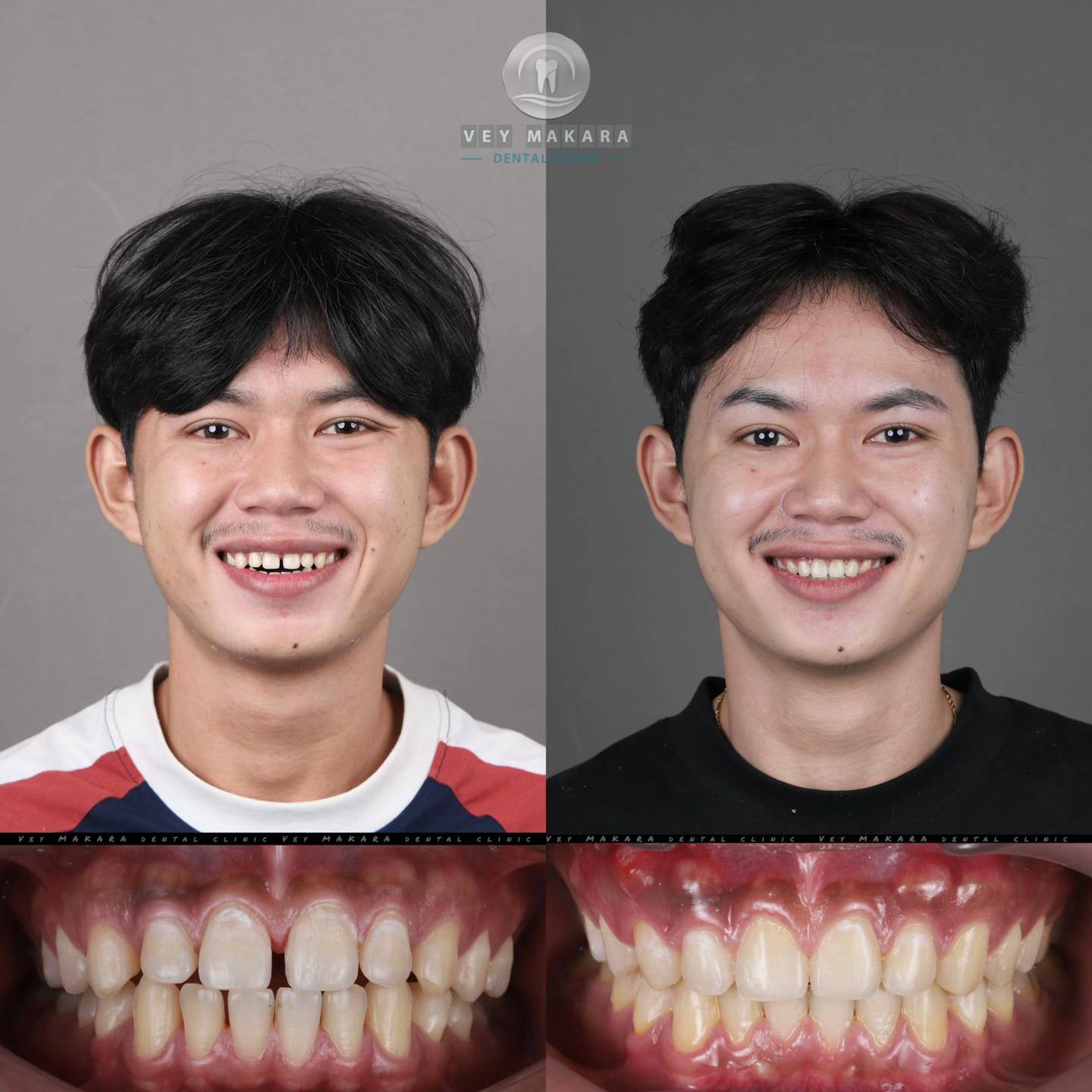 @គ្លីនិកធ្មេញវ័យមករា