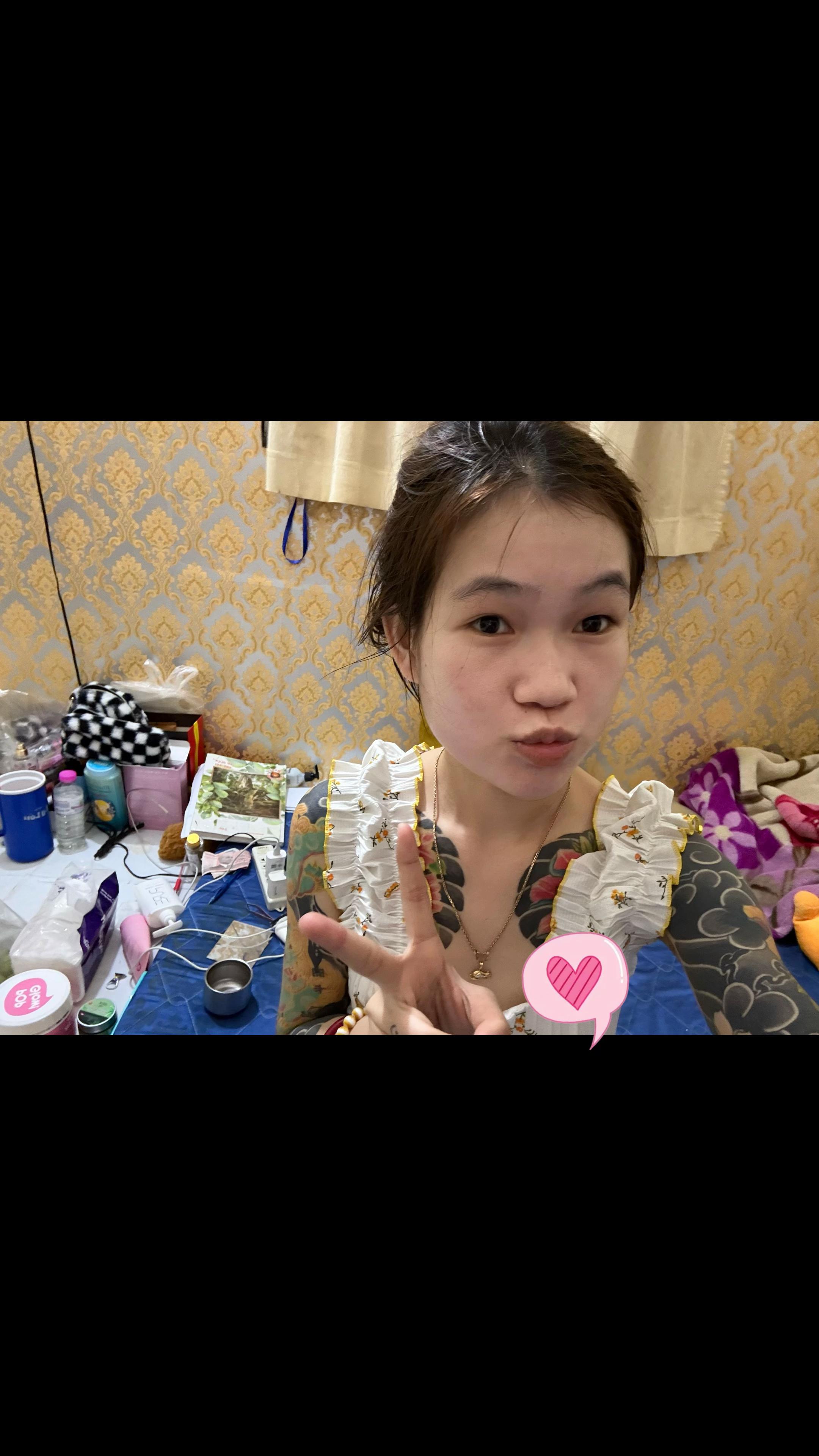 @Ach ko๐