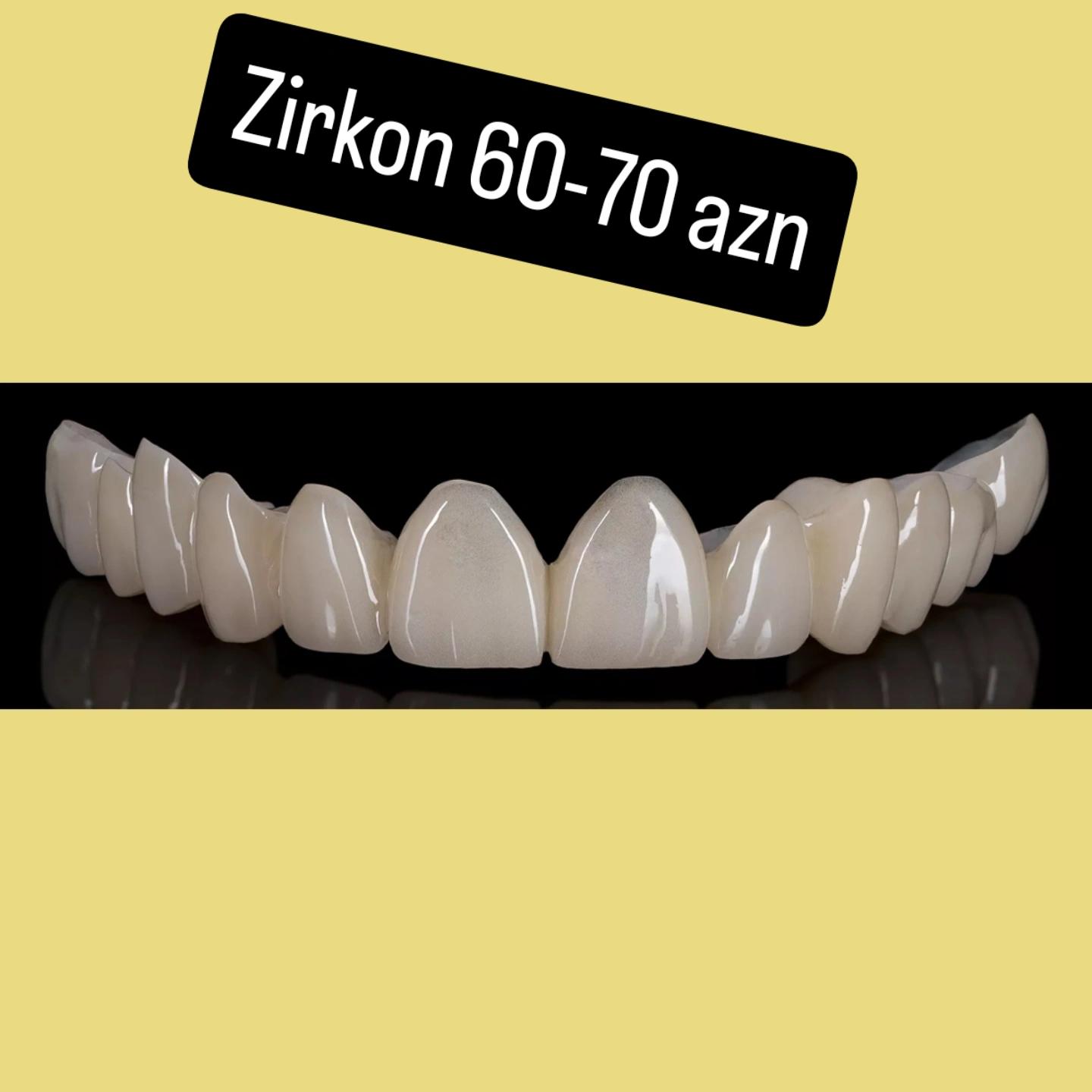 @implant.32