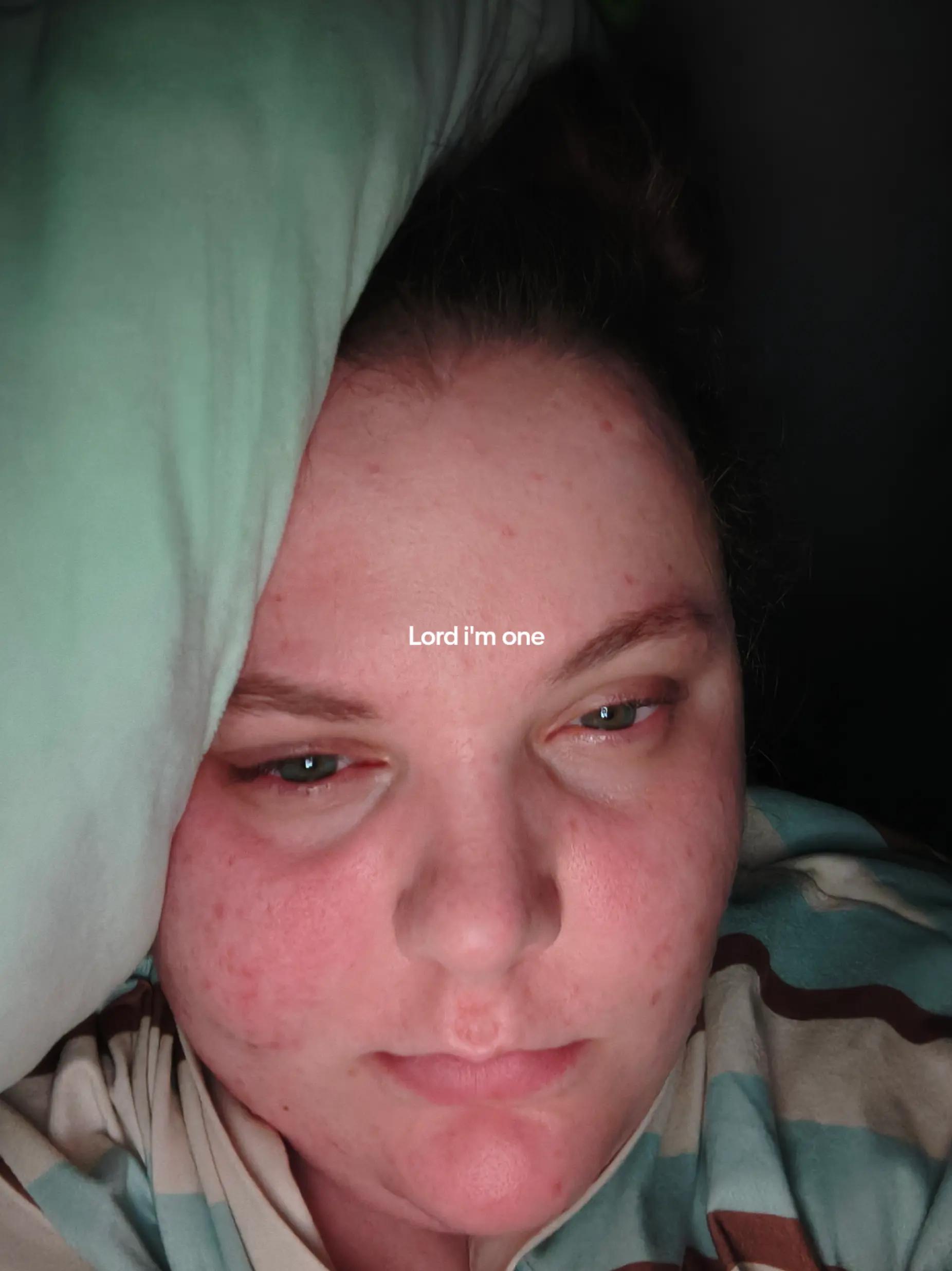 @Chronicwarrior