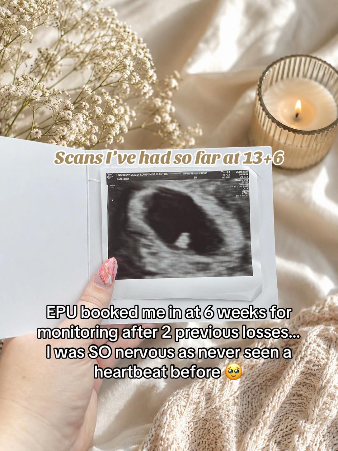 @Stacey🌸| Pregnancy after loss
