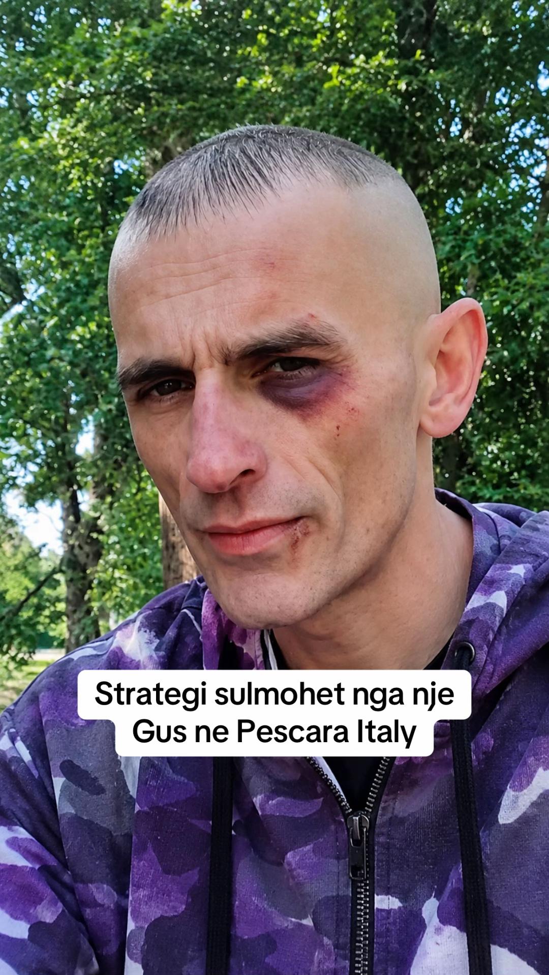 @Hysni Shpuza