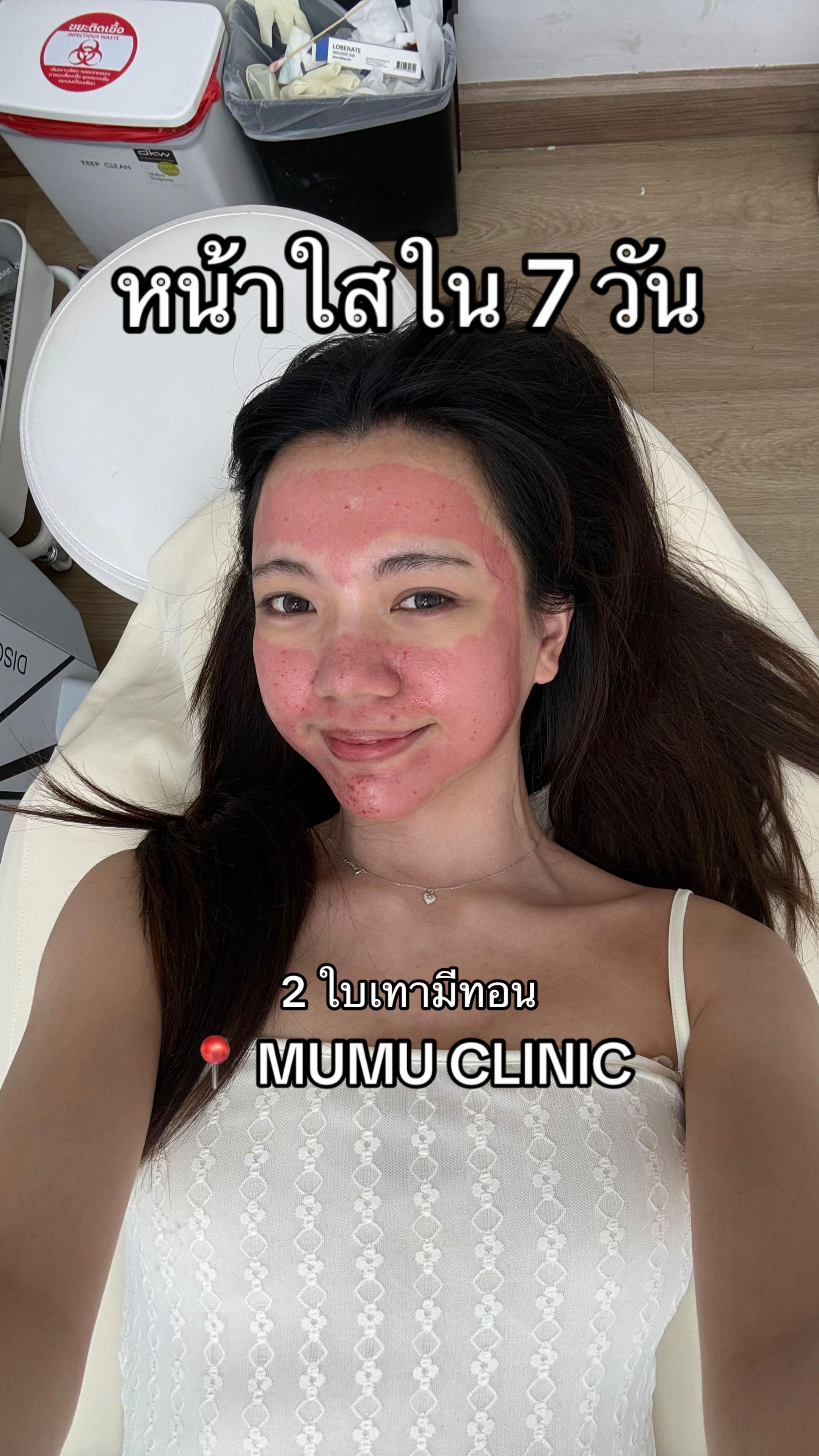 @LINGLING1A