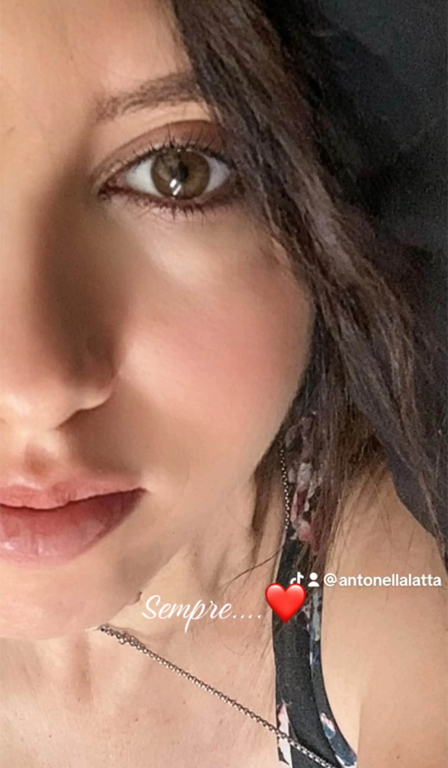 @Anto80