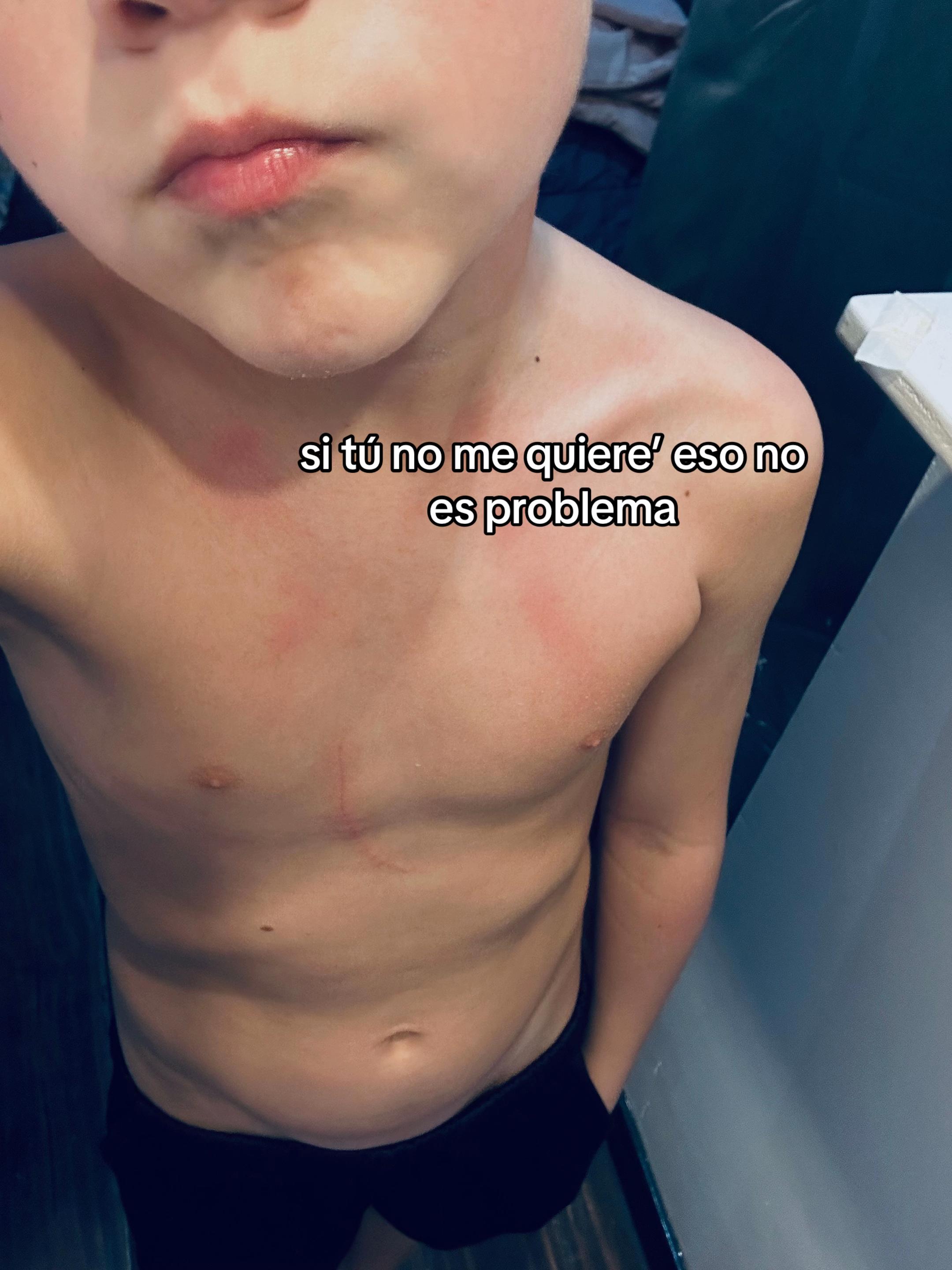 @Juuanii