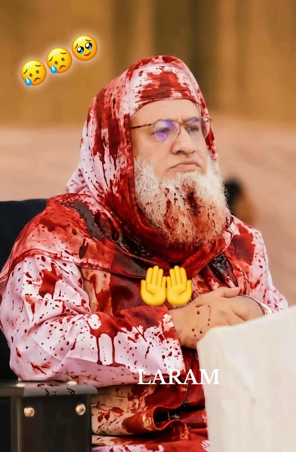 @Riaz 302