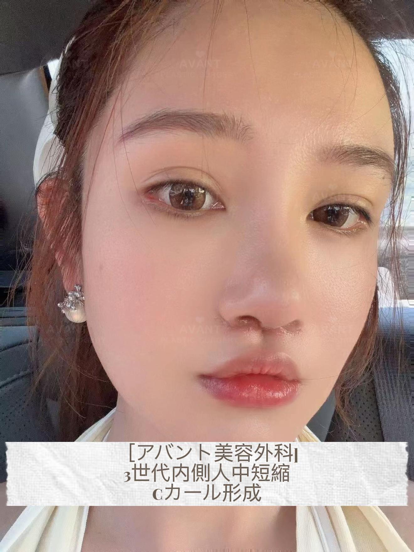 @Avant美容外科