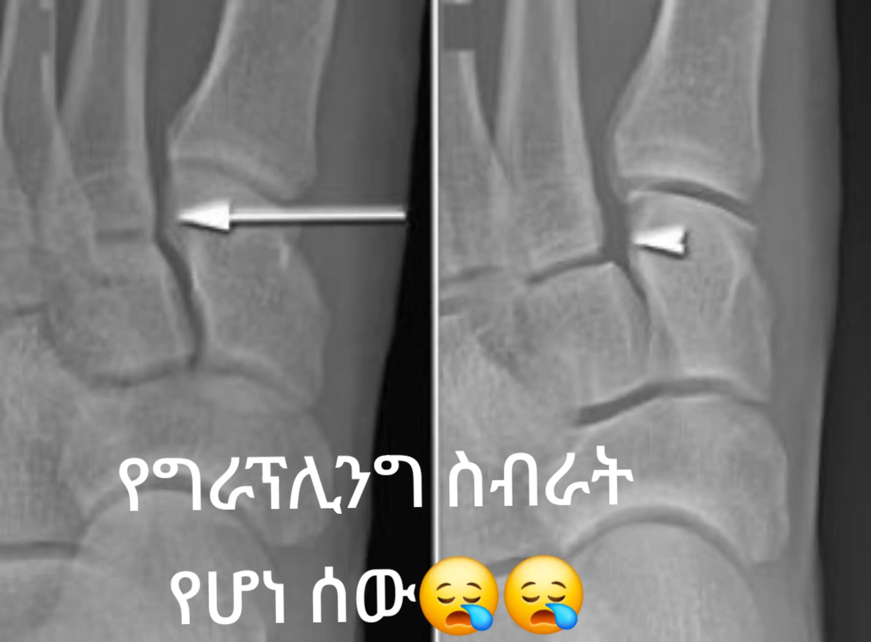 @Dr Wubie Endalew(Radiologist)