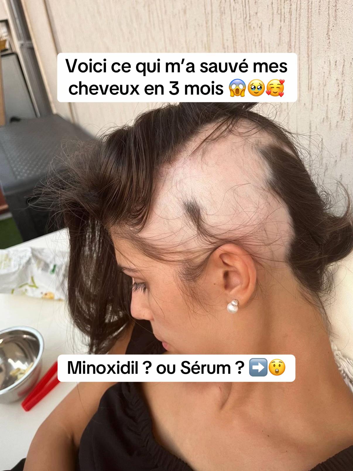 @Lux’Hair Growth