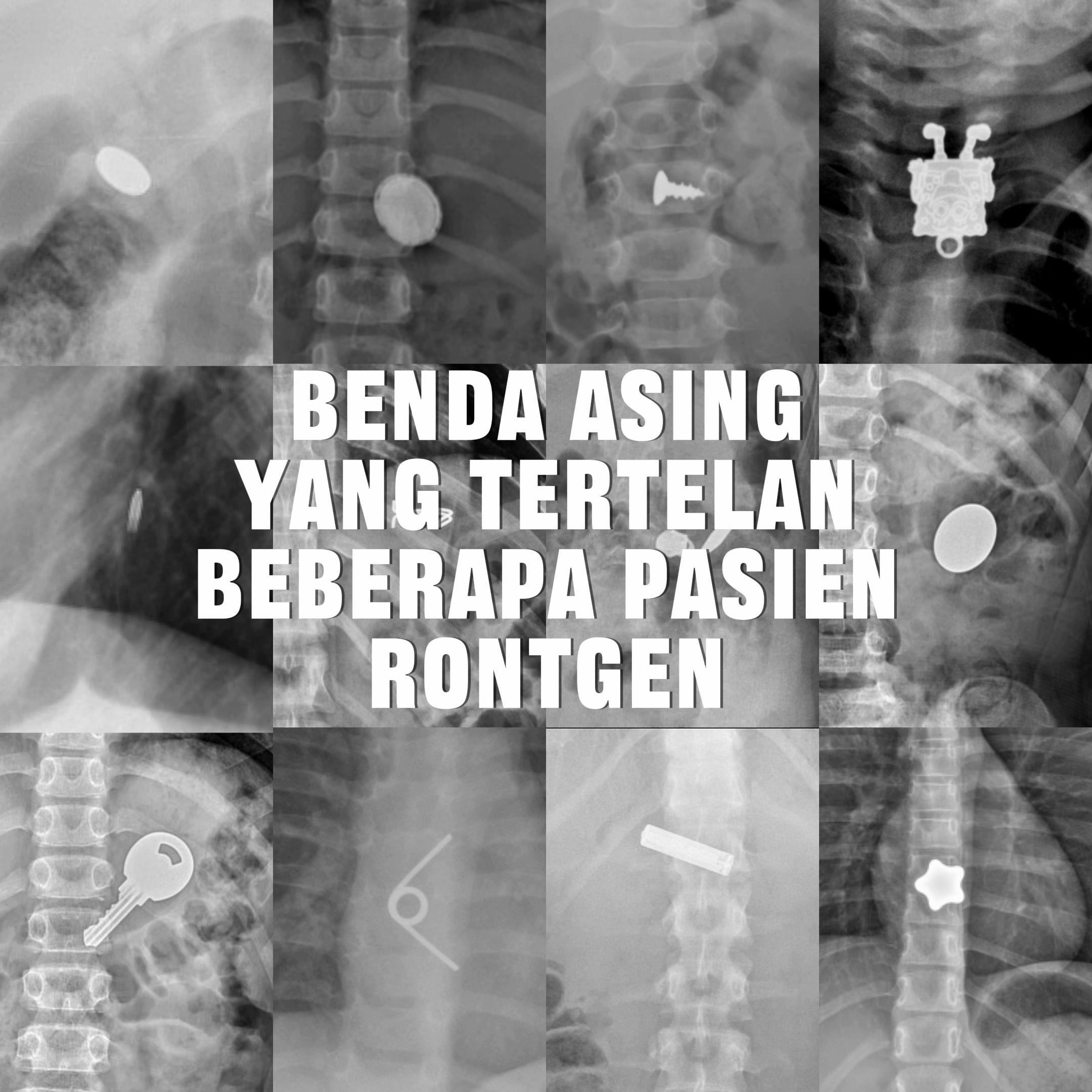 @Sobat Radiology