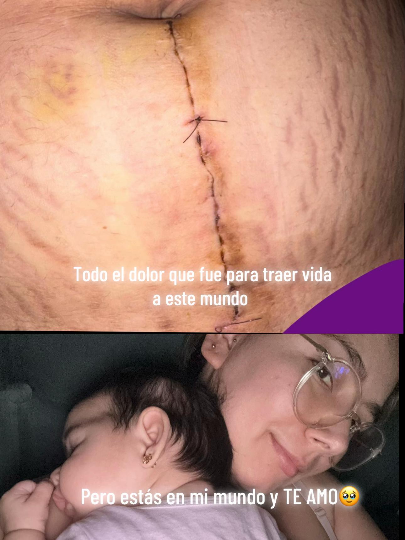 @Maria Rene Mundaca Hinojosa