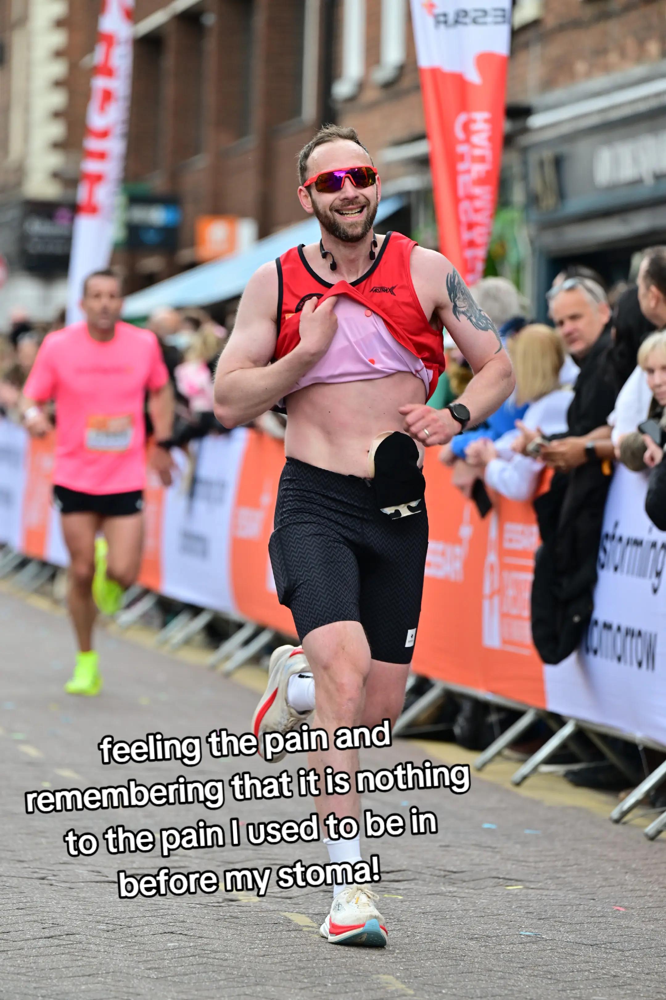 @Running Stoma