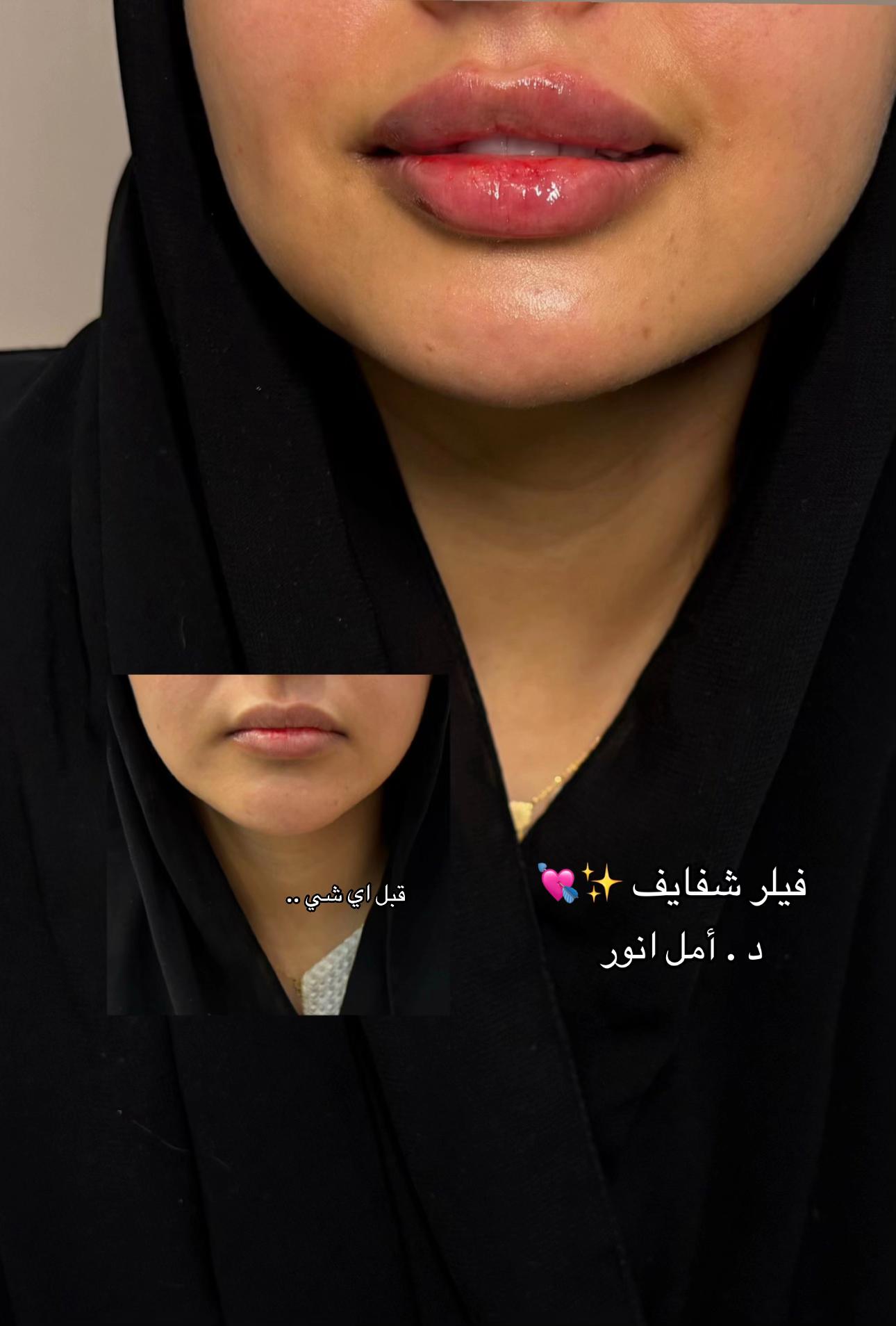 @مركز مزدانه 1 ( فرع الصحافه )
