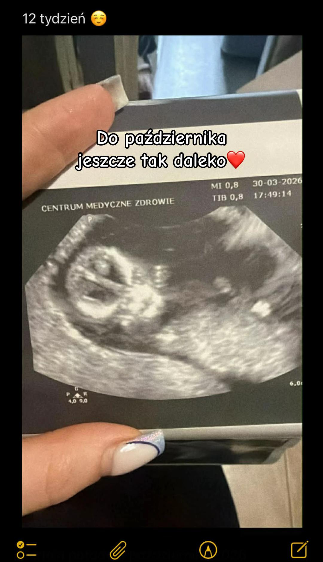 @❤️🔥Andzia❤️🔥