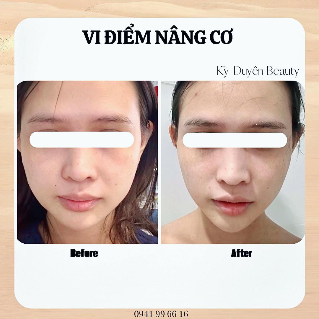 @Cao Kỳ Duyên
