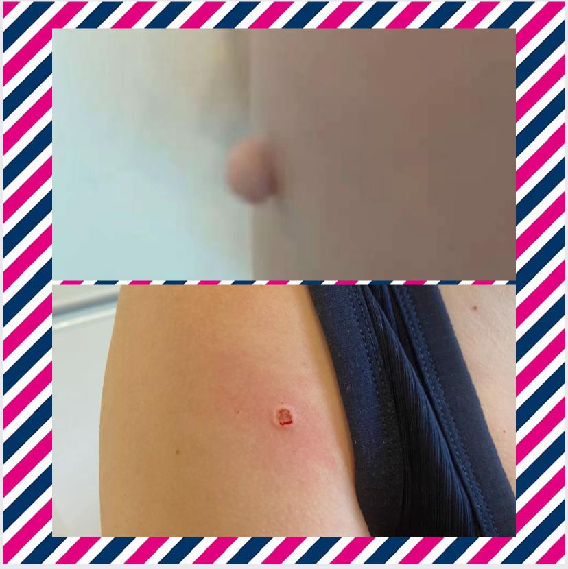 @Diamond Aesthetics Barnsley