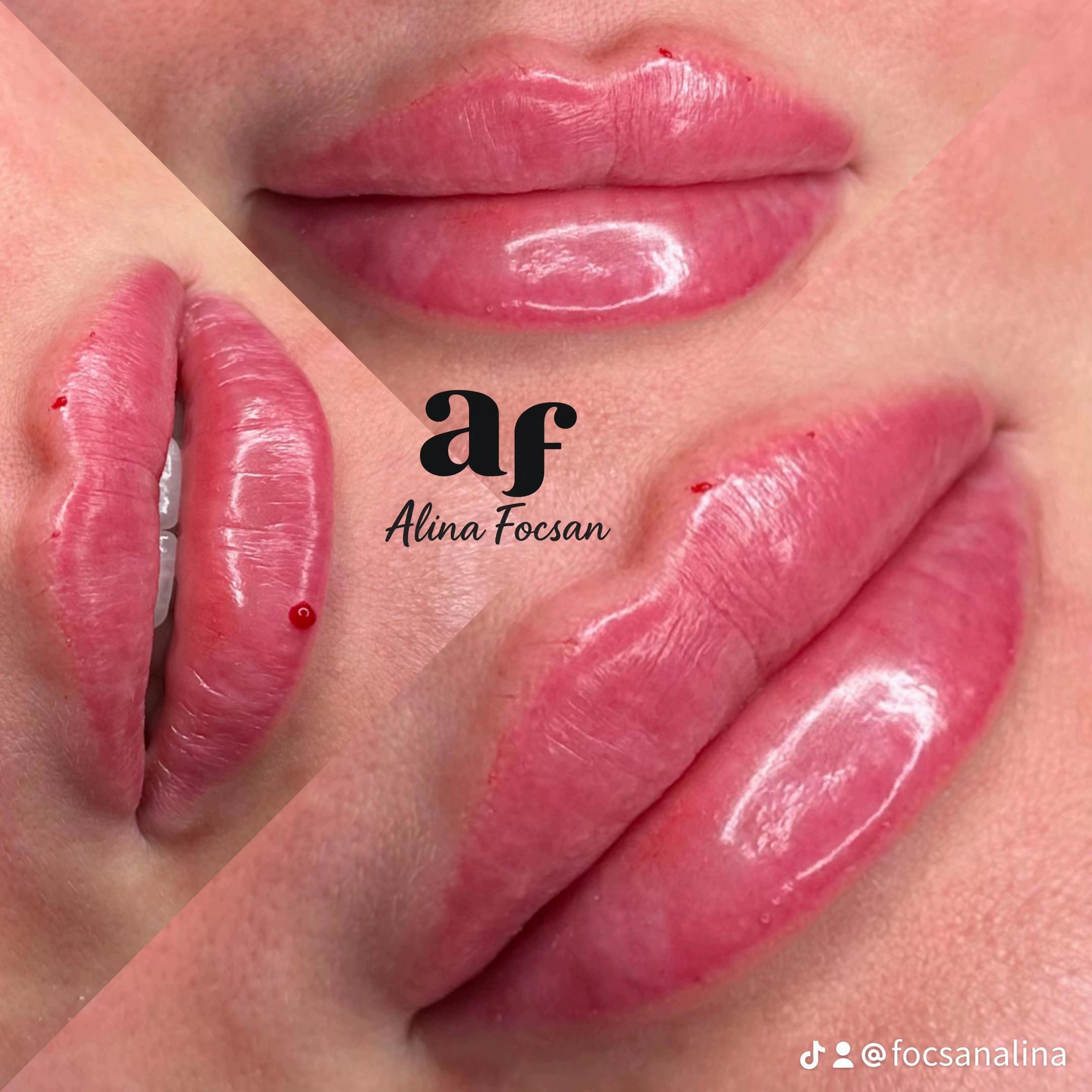 @Alina Focsan