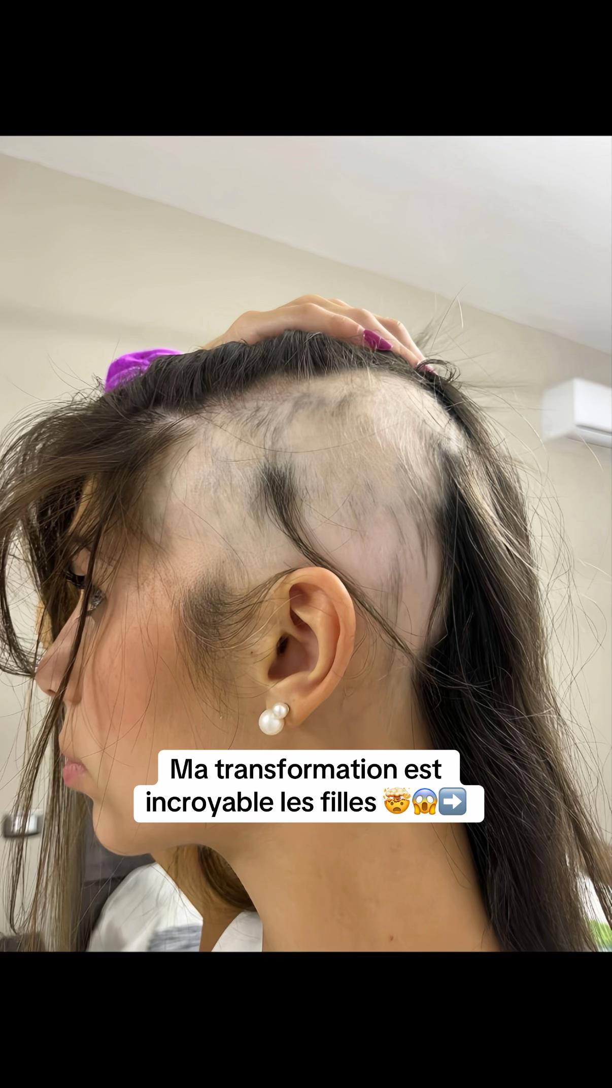 @Lux’Hair Growth FR