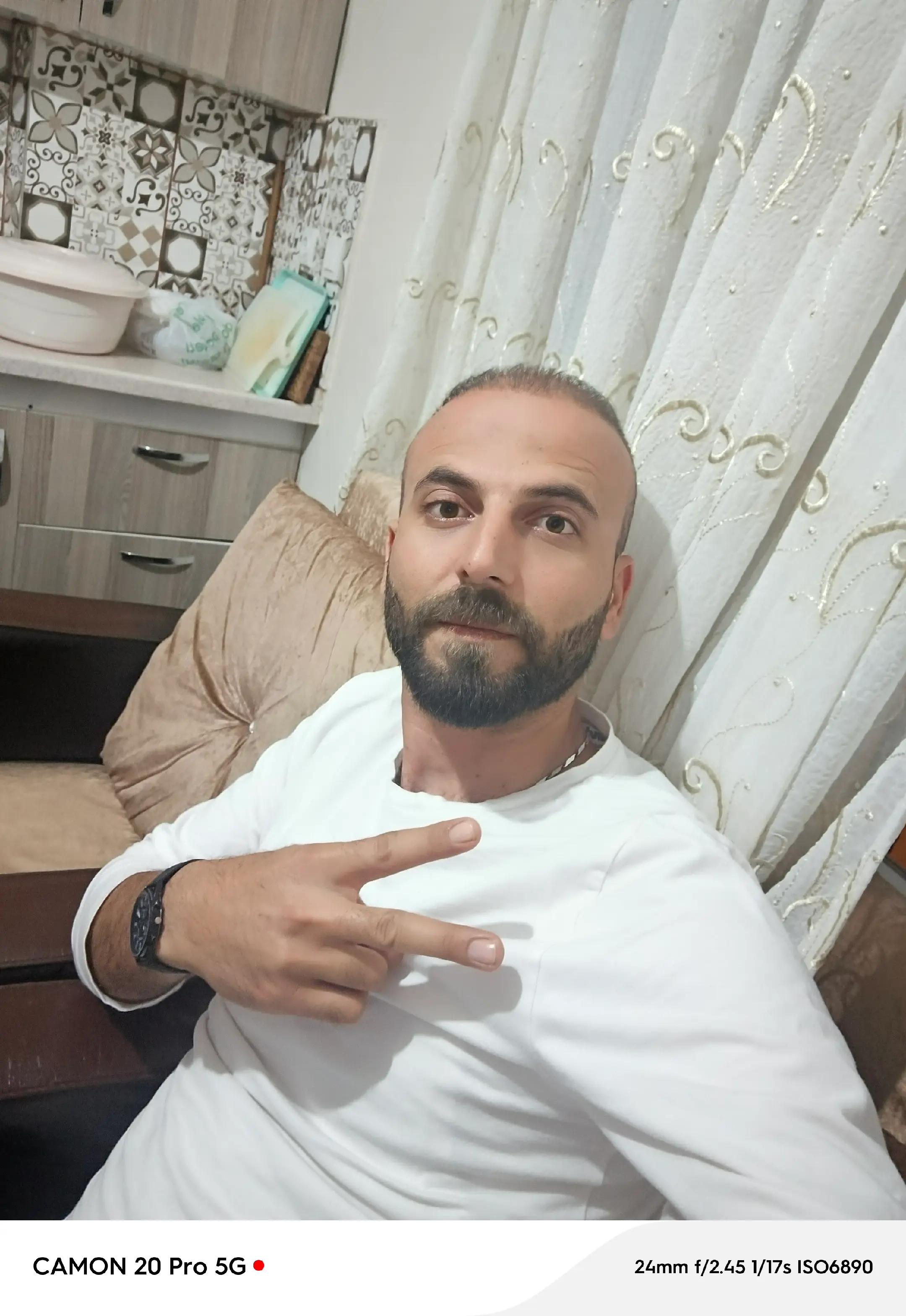 @Ahmetkpln3372