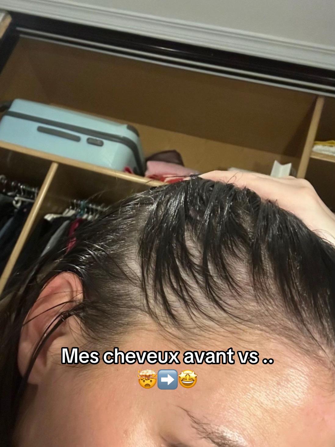 @Lux’Hair Growth FR