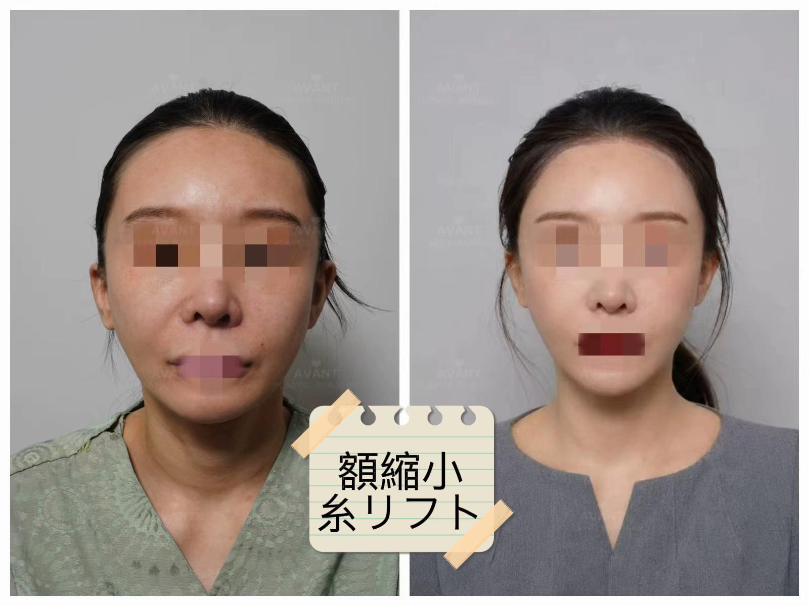 @Avant美容外科