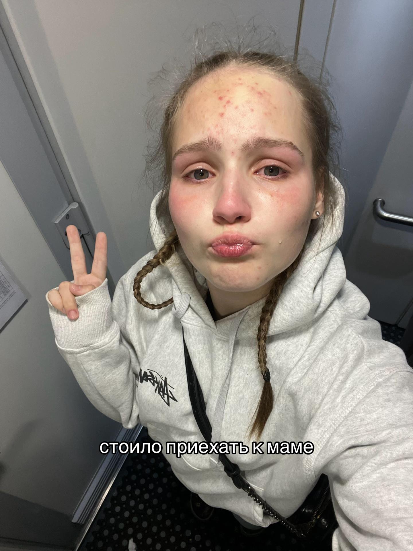 @фольксваген поля