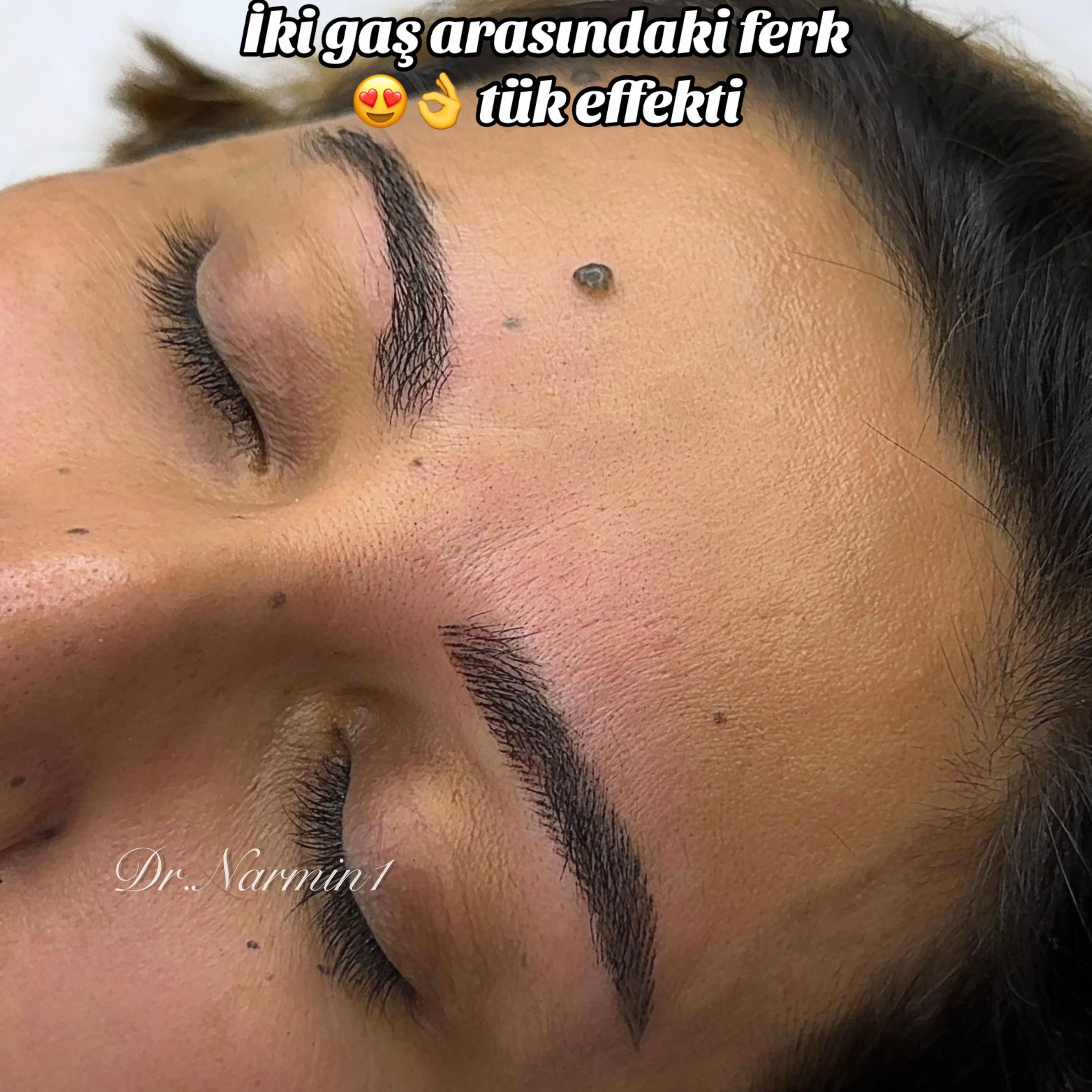 @Pm.N_permanent.marneuli