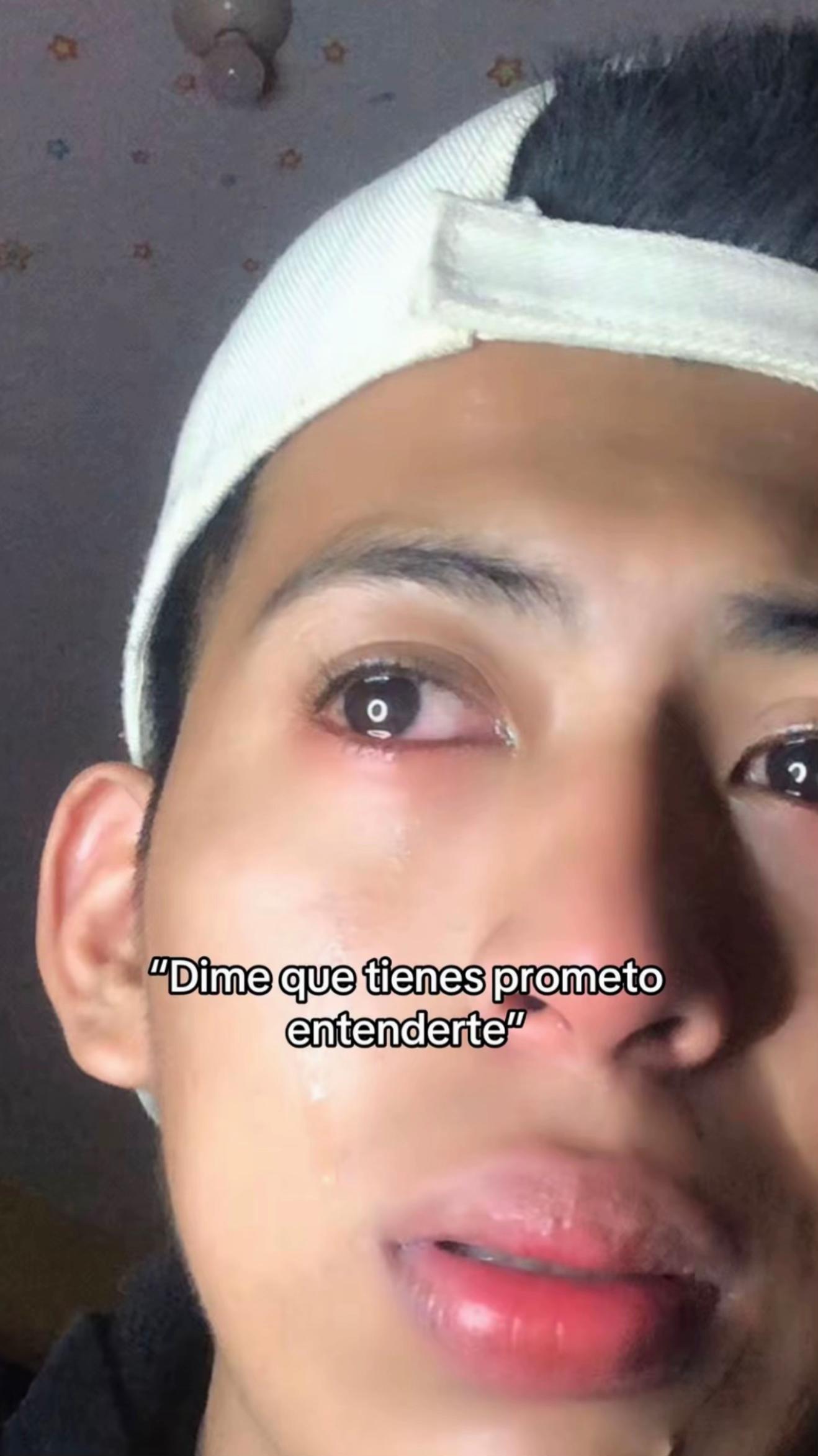 @Fernando🎗️