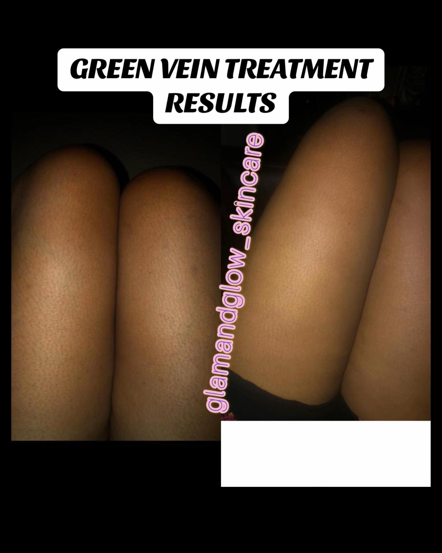 @SKIN REPAIR TREATMENT EXPERT