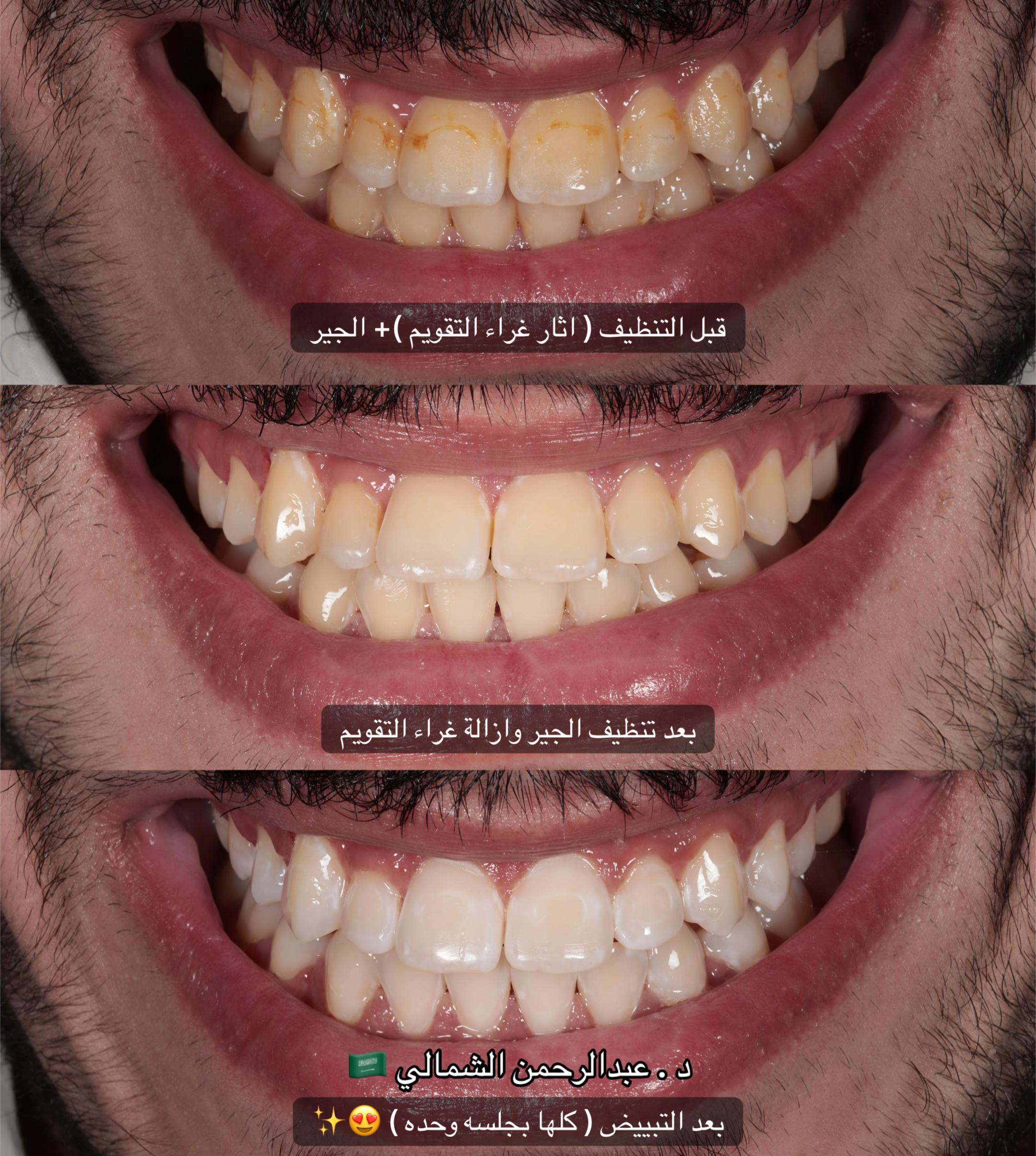 @مركز مزدانه 1 ( فرع الصحافه )