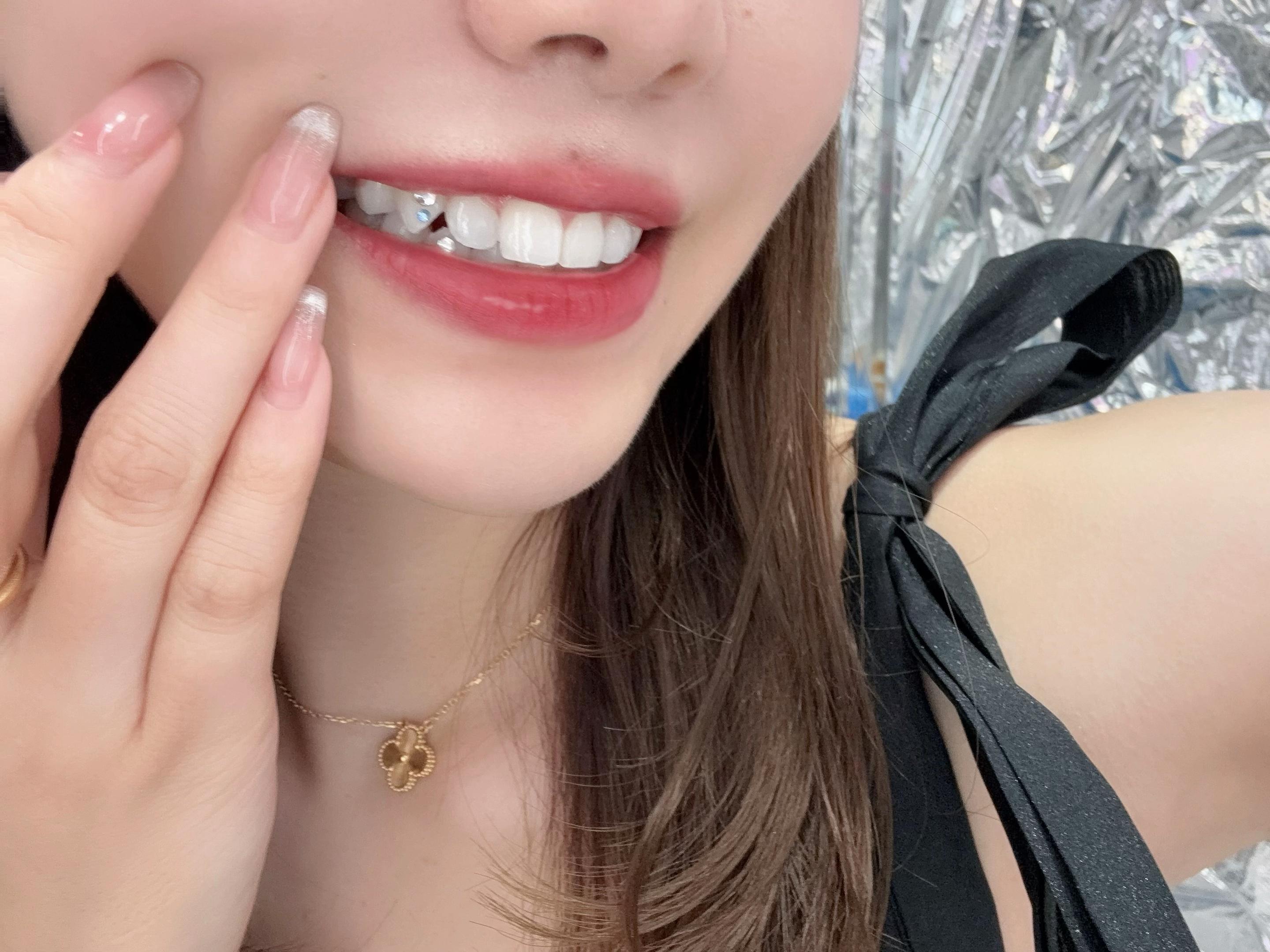 @DENTAL ALIEN