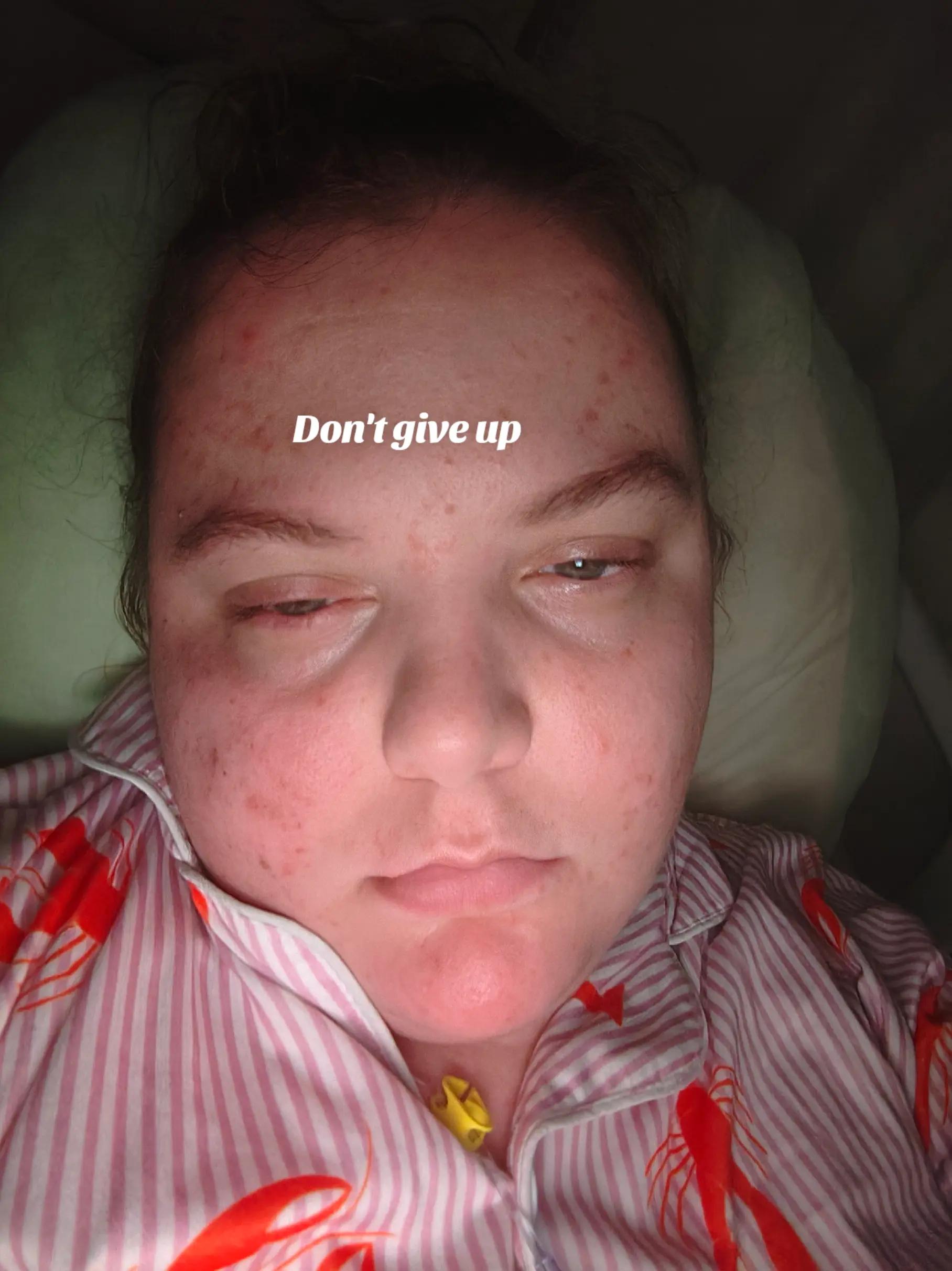 @Chronicwarrior