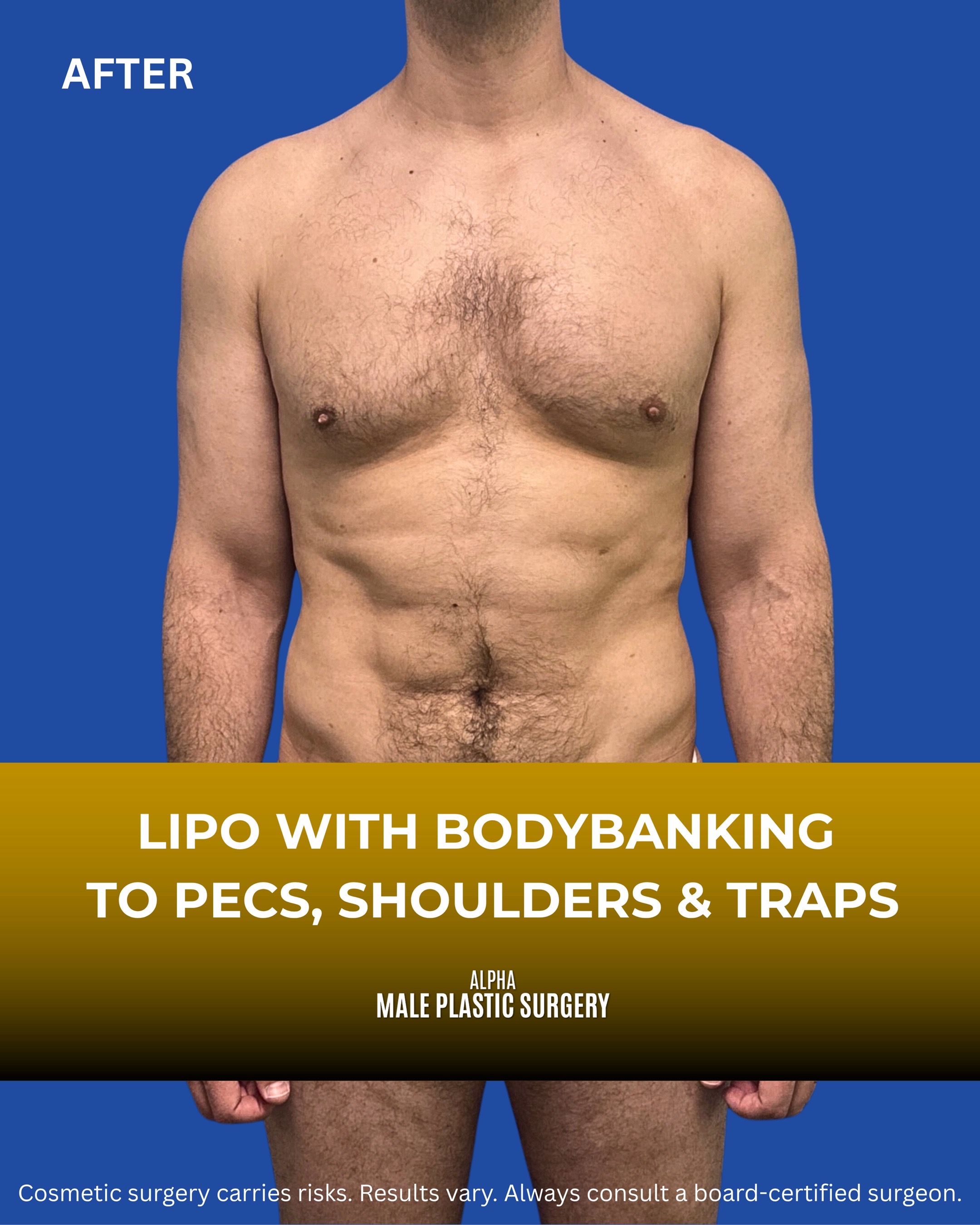 @mensplasticsurgery