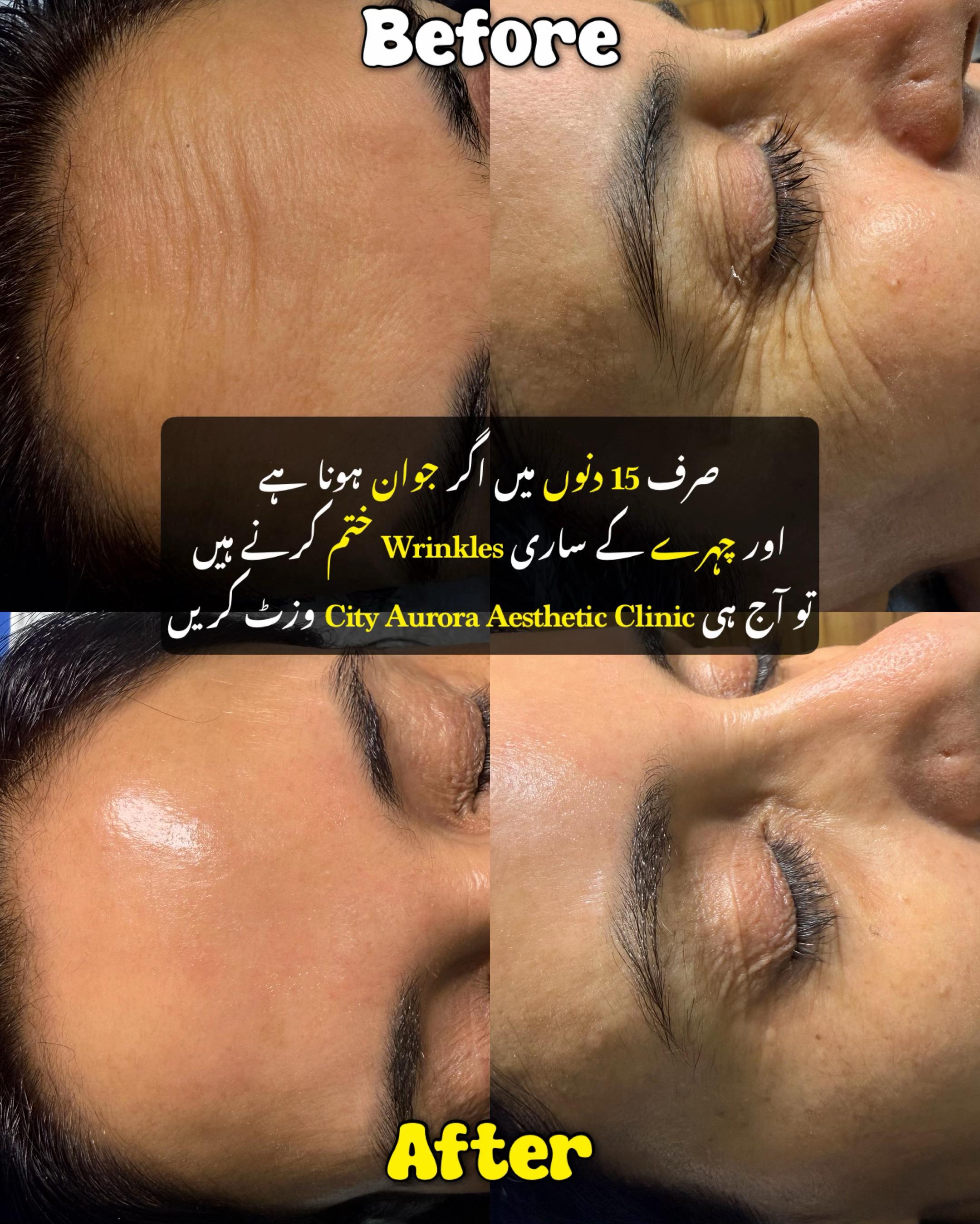 @City Aurora Asthetic clinic