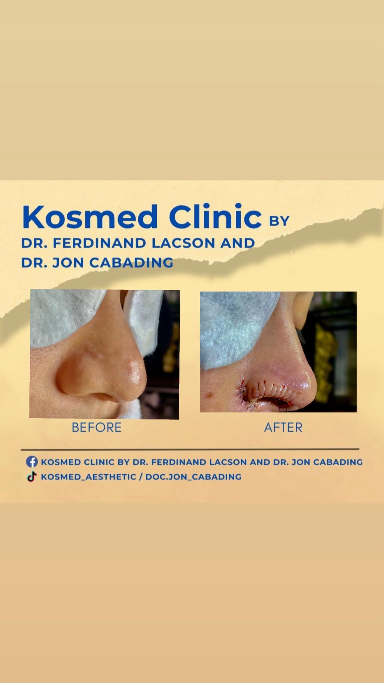 @doc.jon_cabading