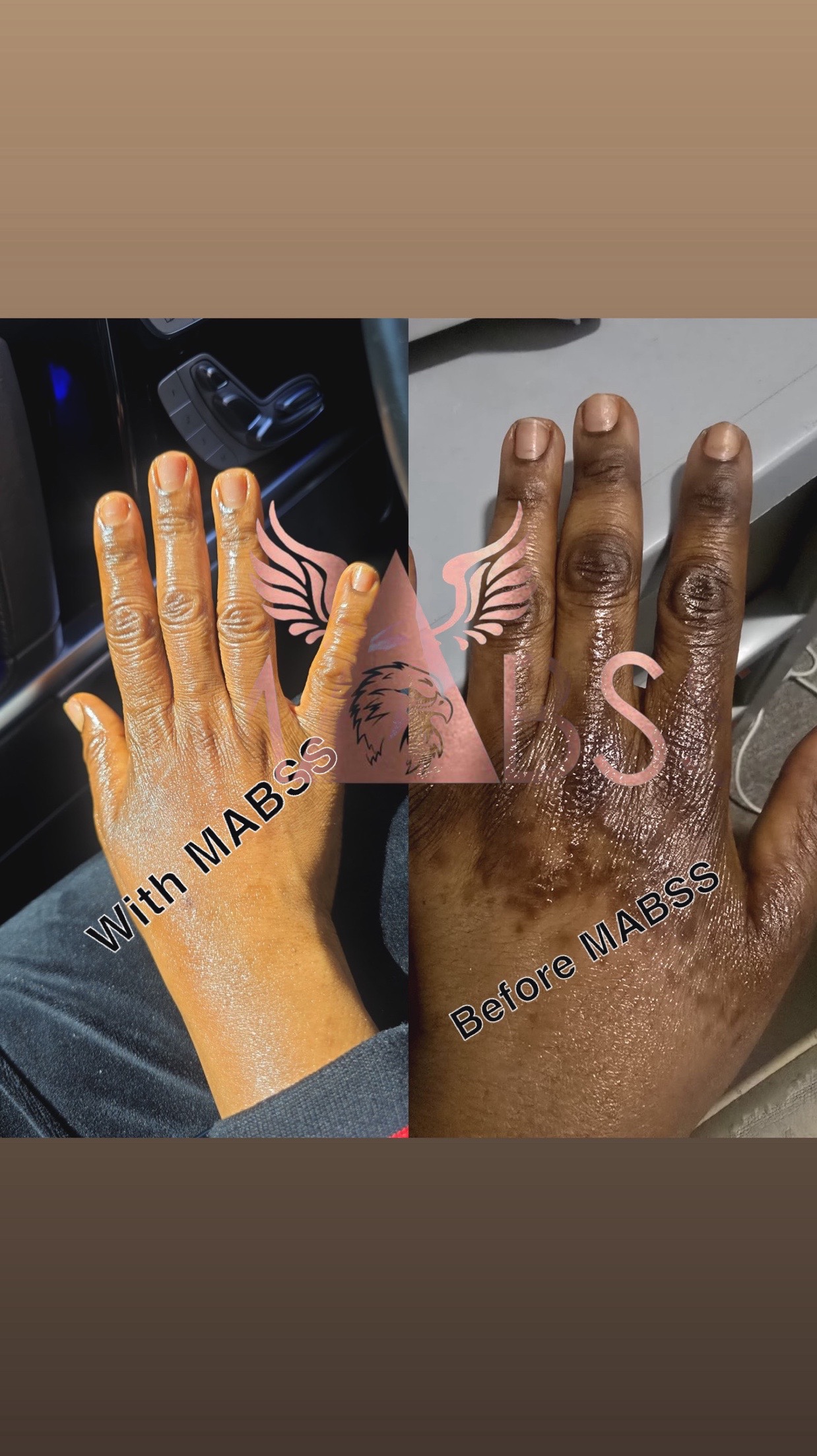 @MABSS SKINCARE