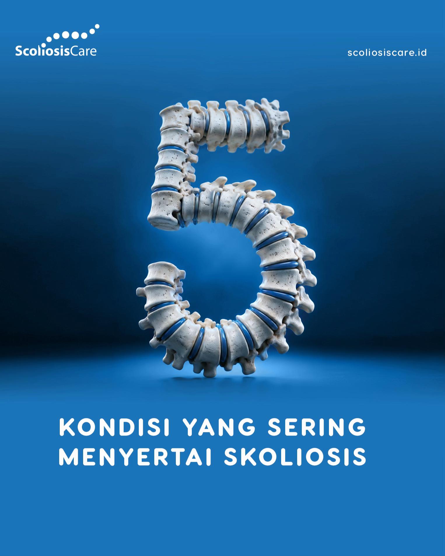@Scoliosis Care