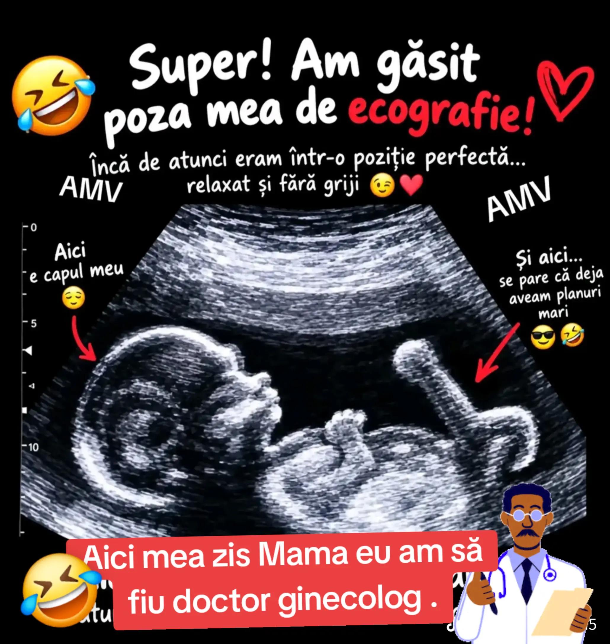 @Aurel Anghelus_22