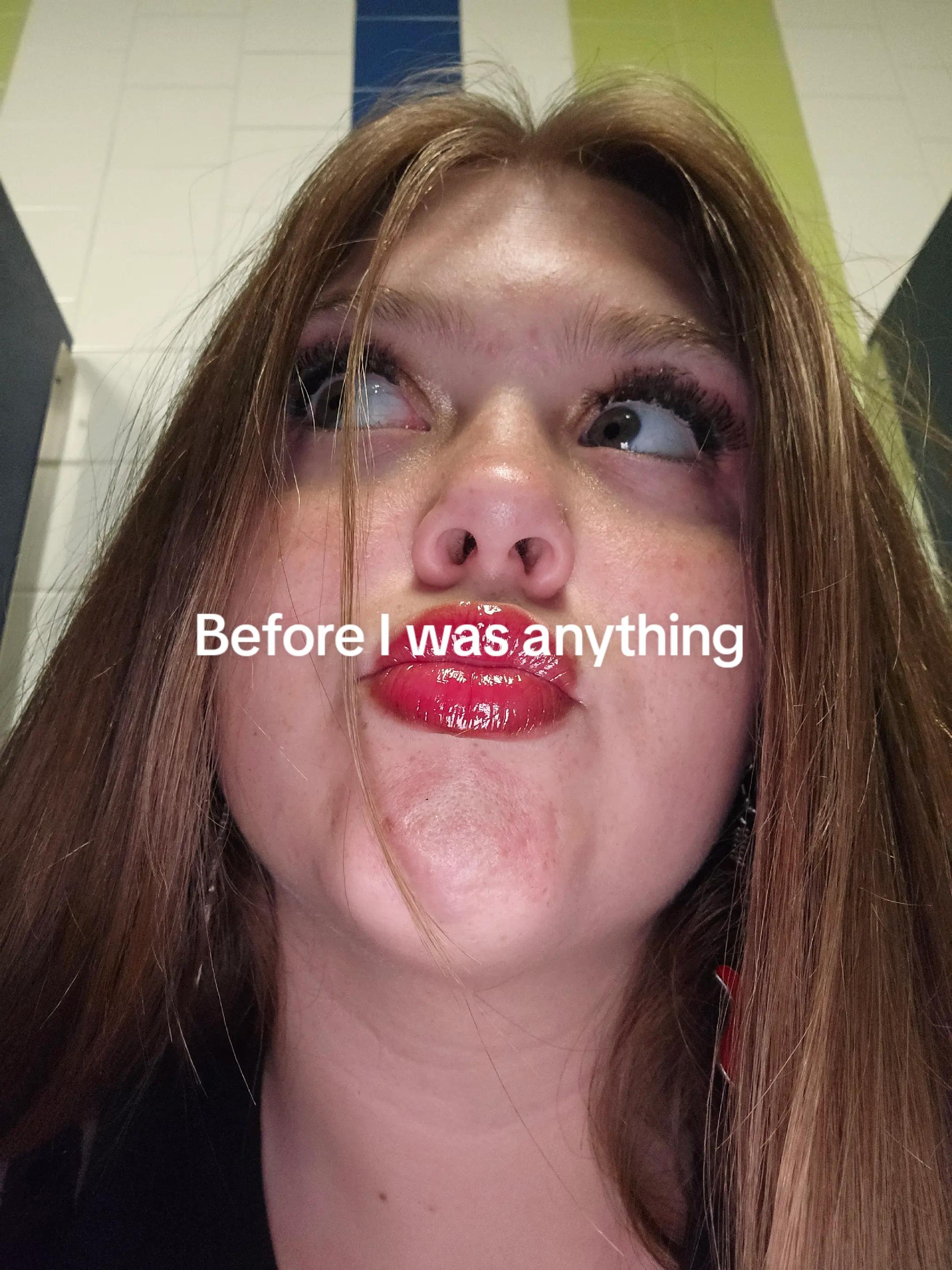@JaybrahamLincoln 👩🏽🦯