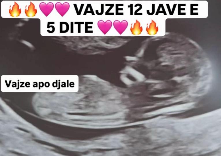 @Vajze apo Djale? 💙💖