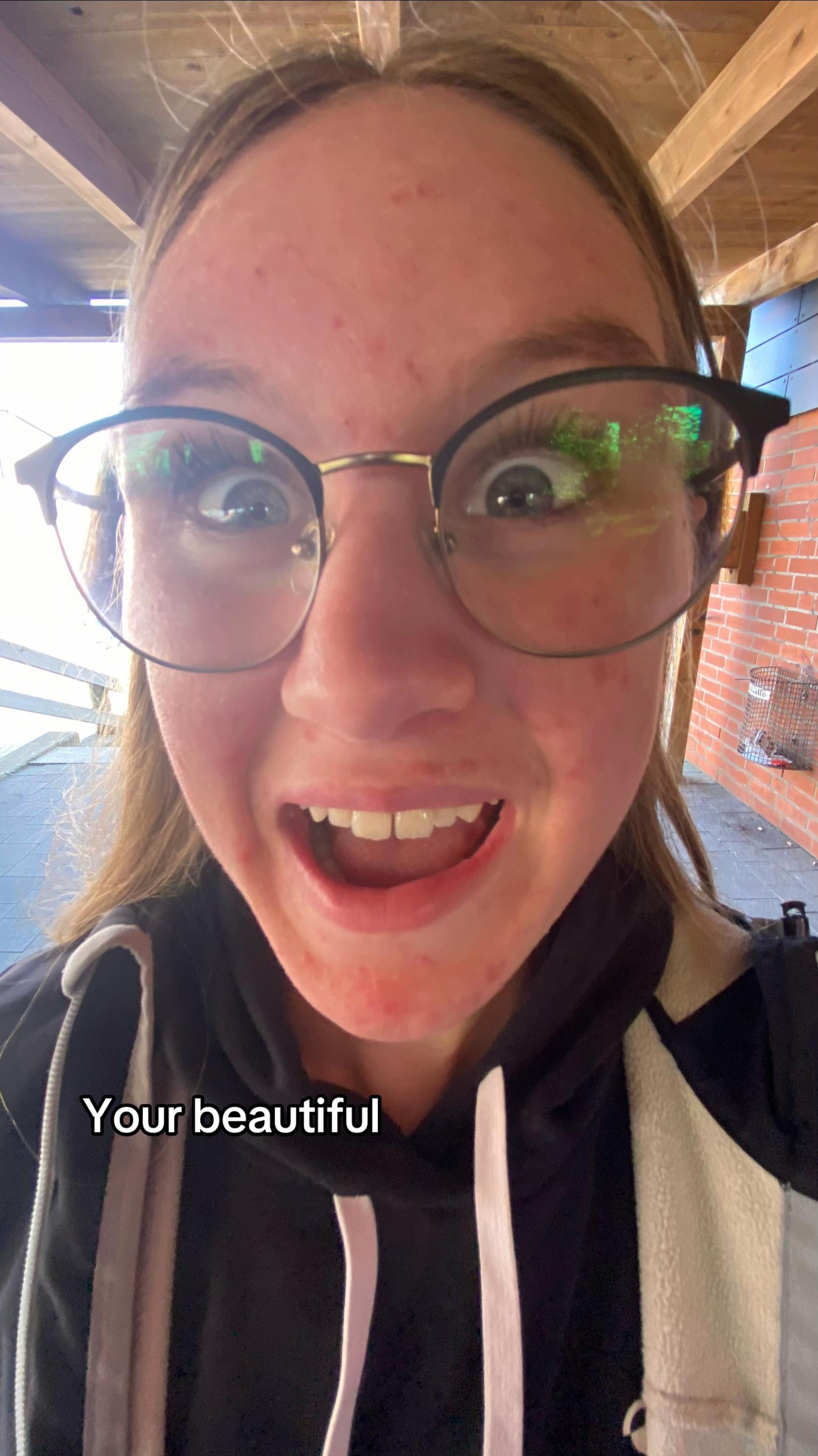 @emily