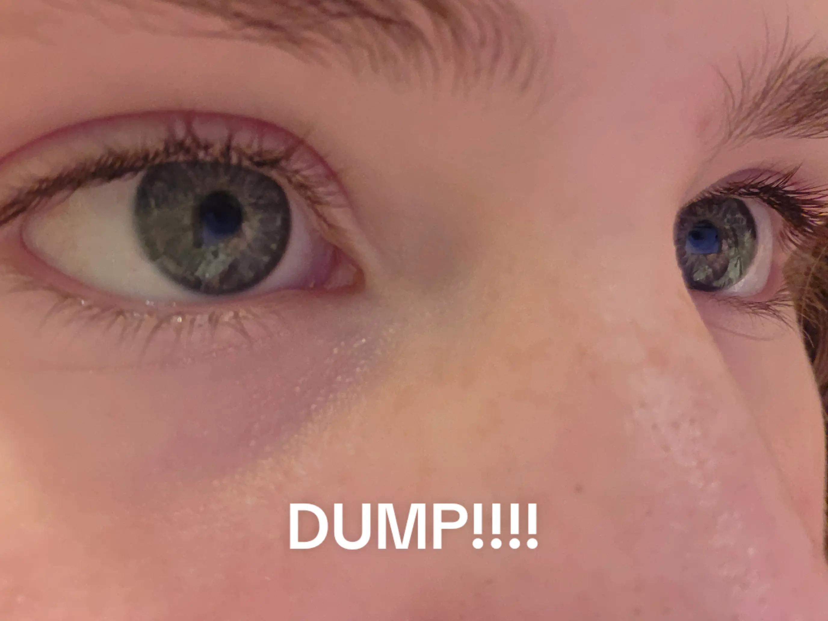 @hopeyyy